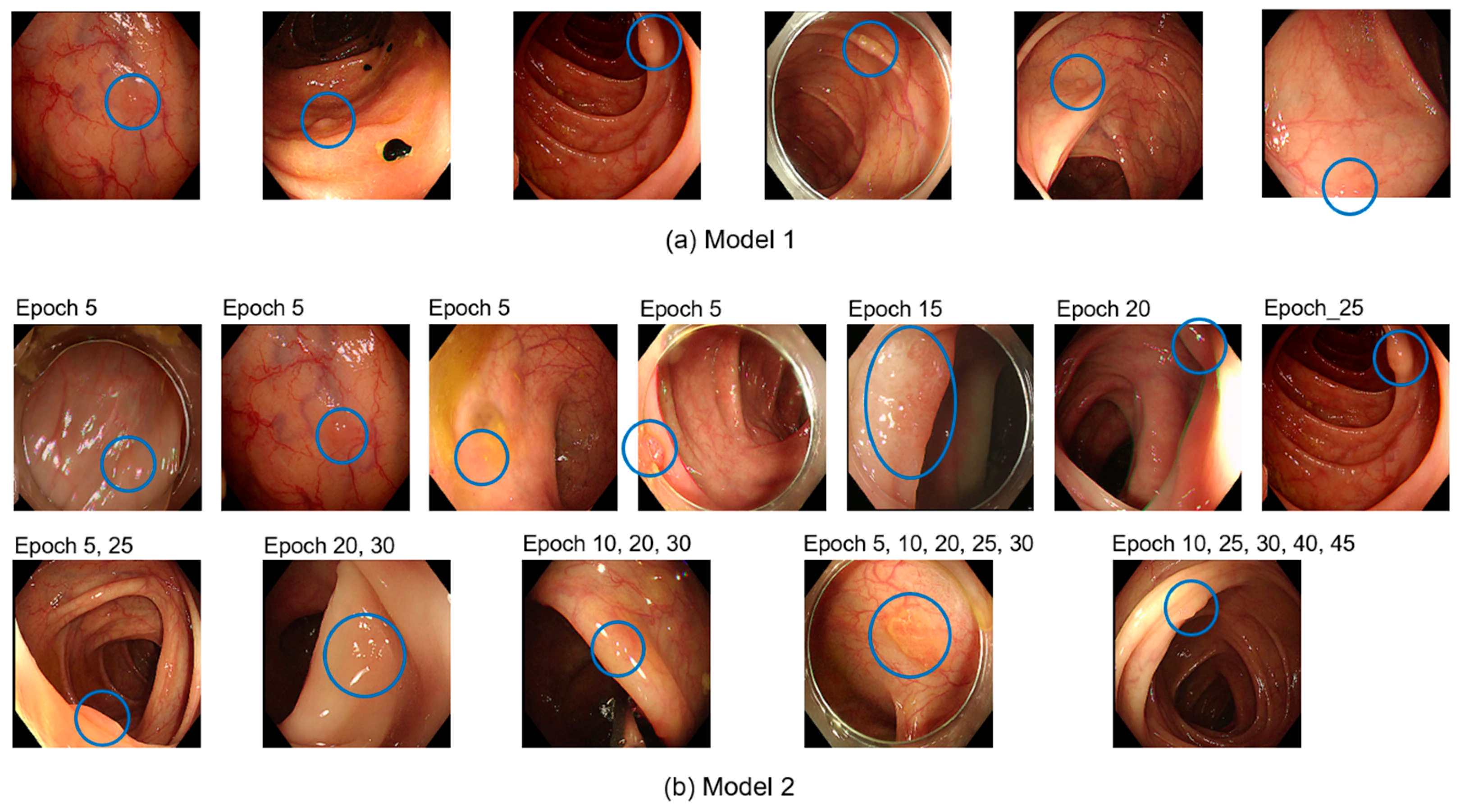 Diagnostics 15 00901 g004