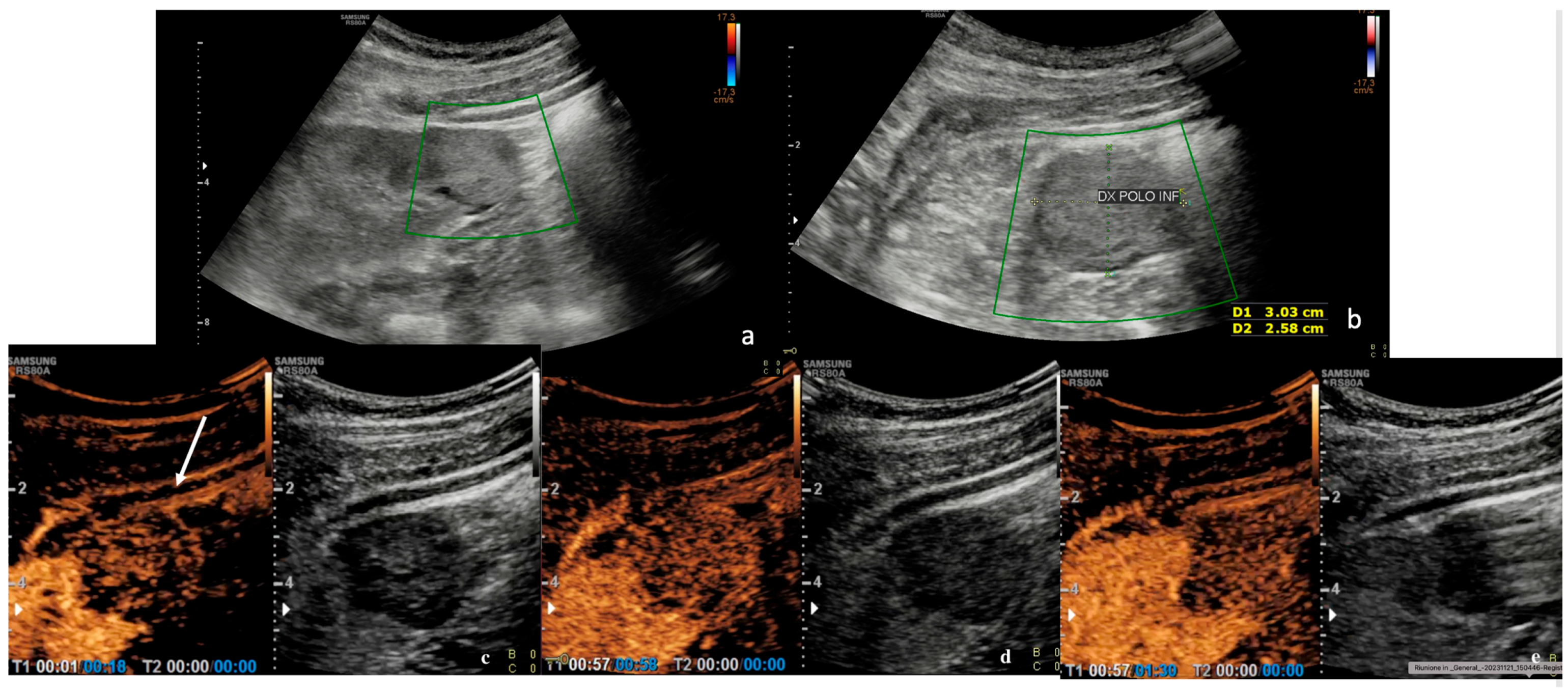 Diagnostics 15 00906 g003
