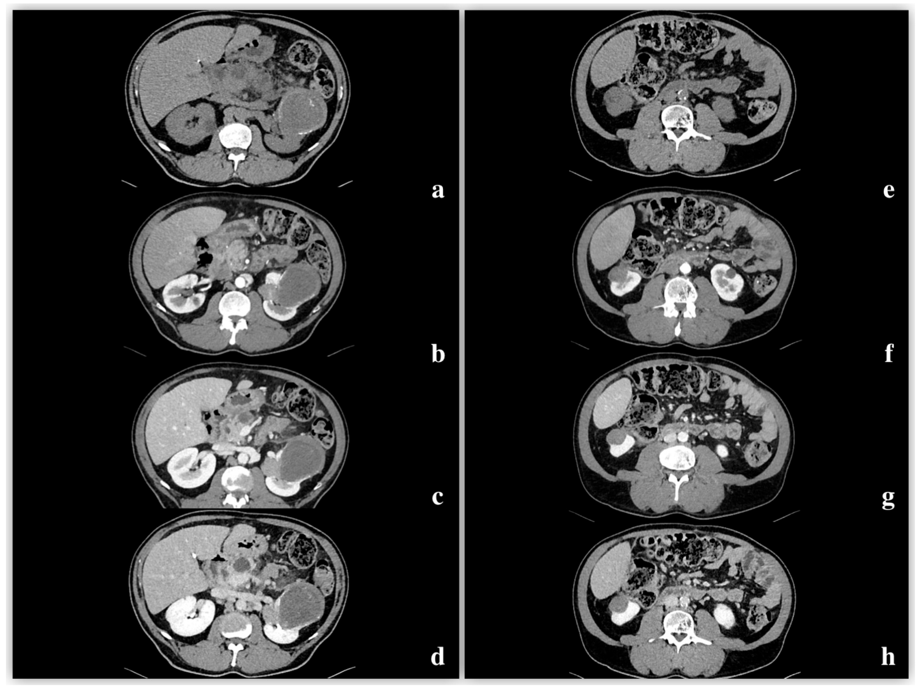 Diagnostics 15 00906 g004