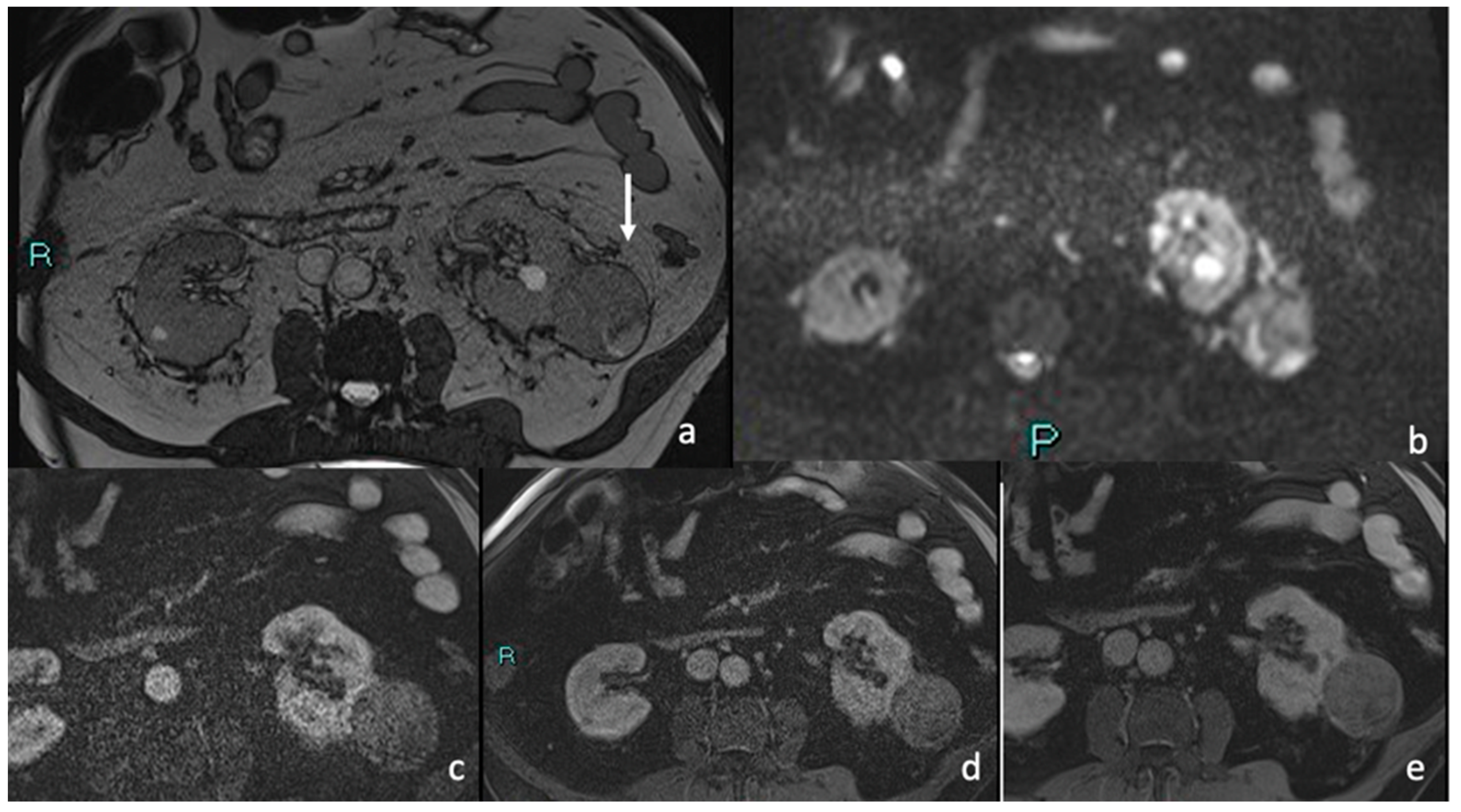Diagnostics 15 00906 g006