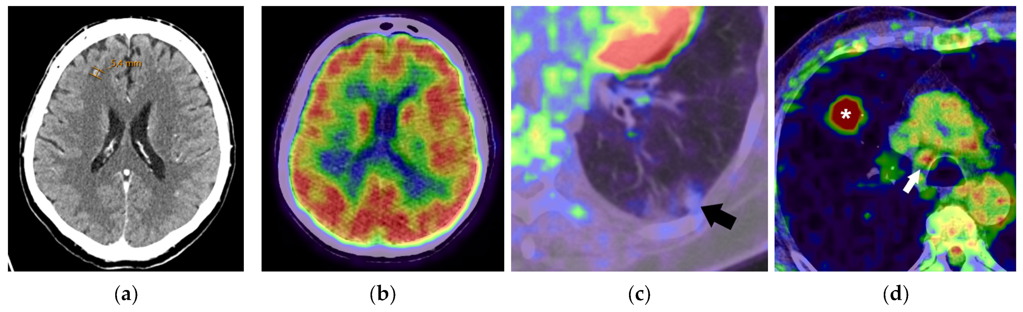 Diagnostics 15 00908 g001