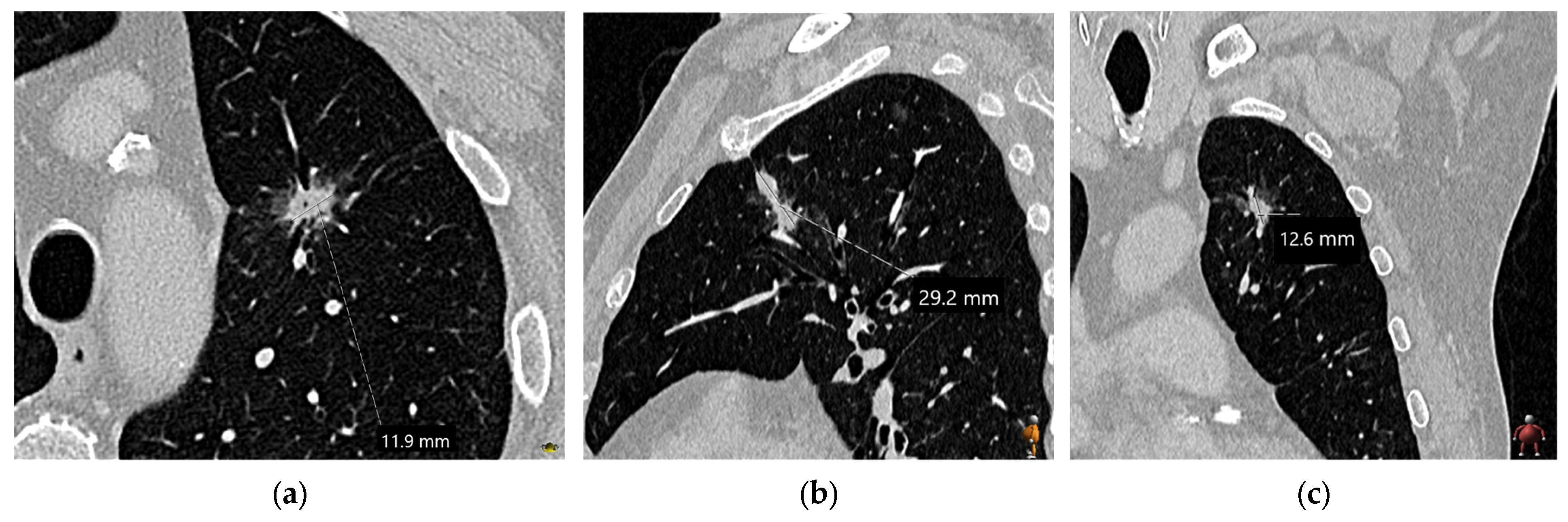 Diagnostics 15 00908 g003