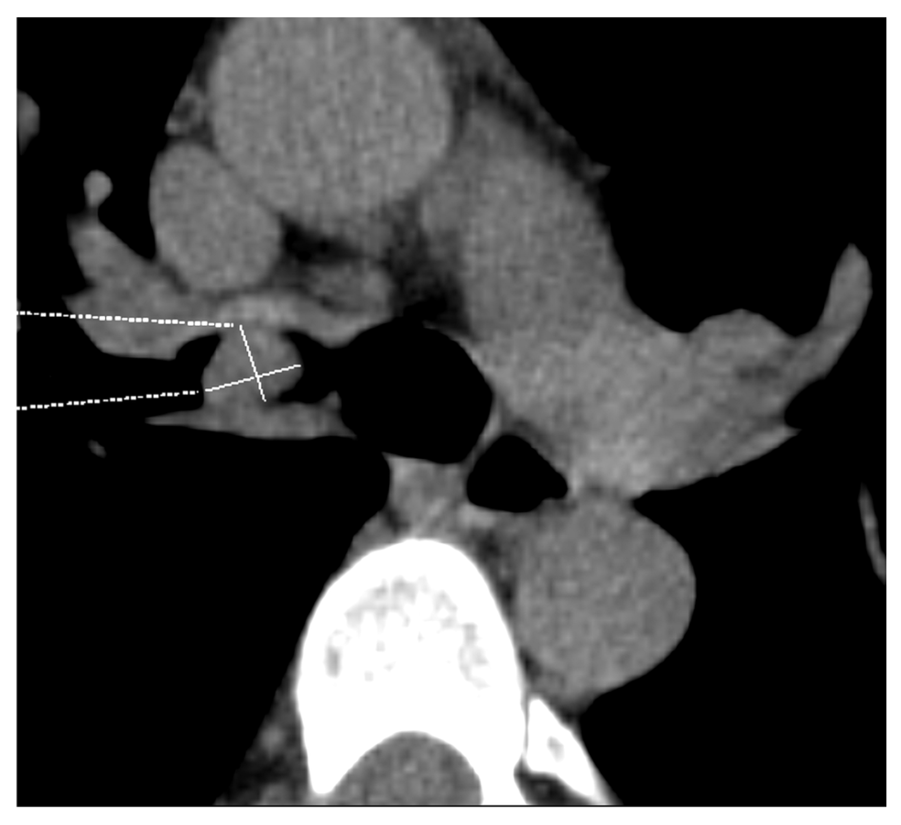 Diagnostics 15 00908 g007