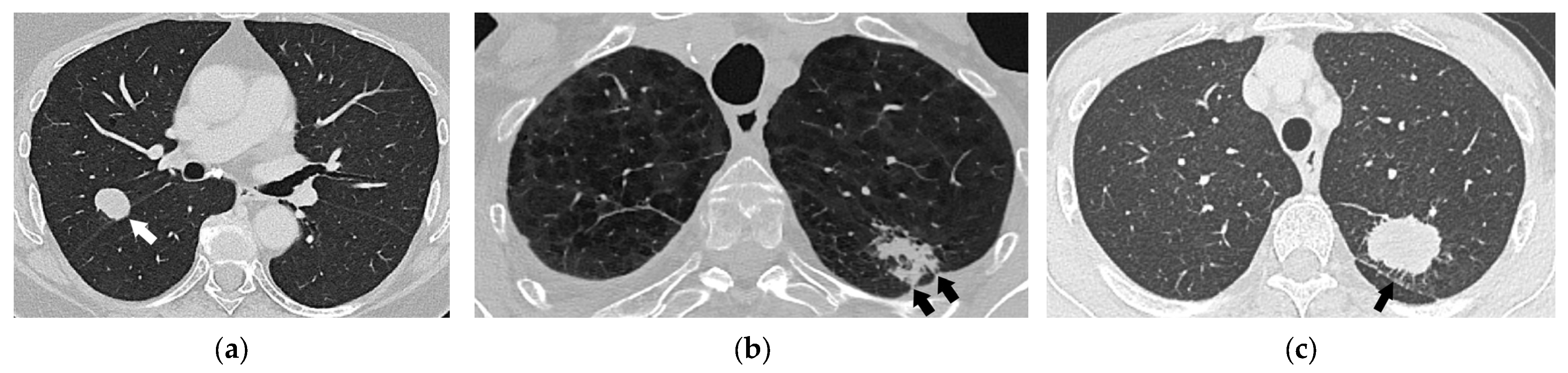 Diagnostics 15 00908 g008