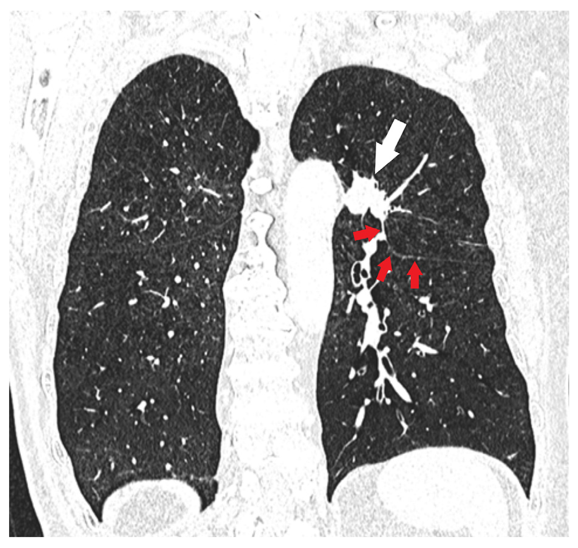 Diagnostics 15 00908 g009