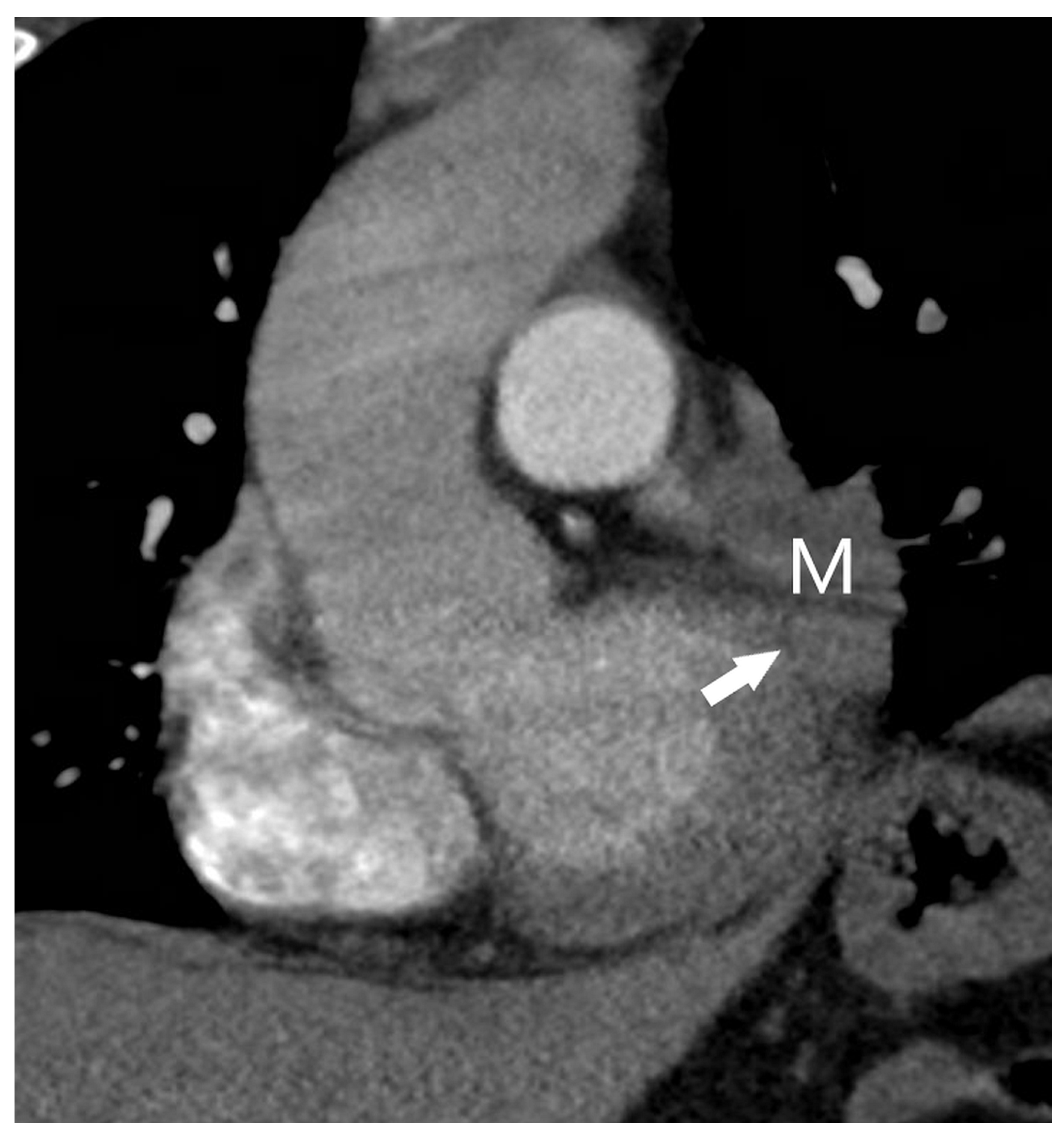 Diagnostics 15 00908 g010