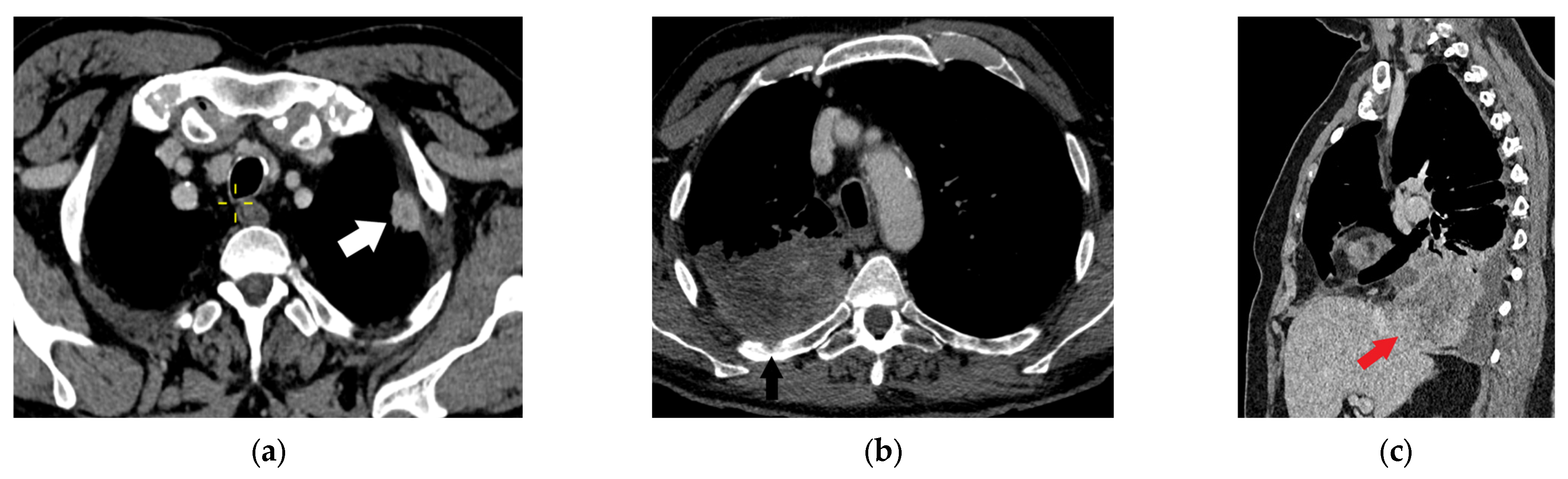Diagnostics 15 00908 g011