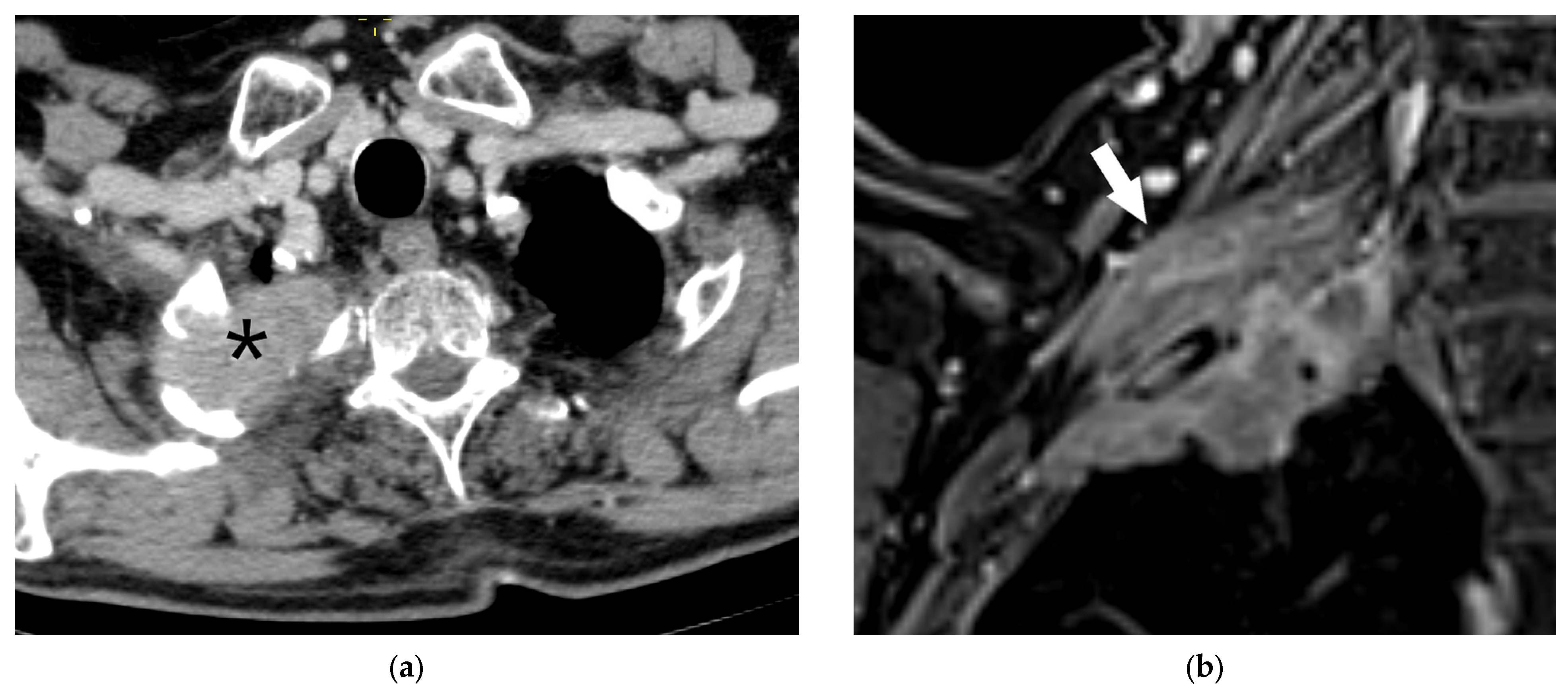 Diagnostics 15 00908 g012