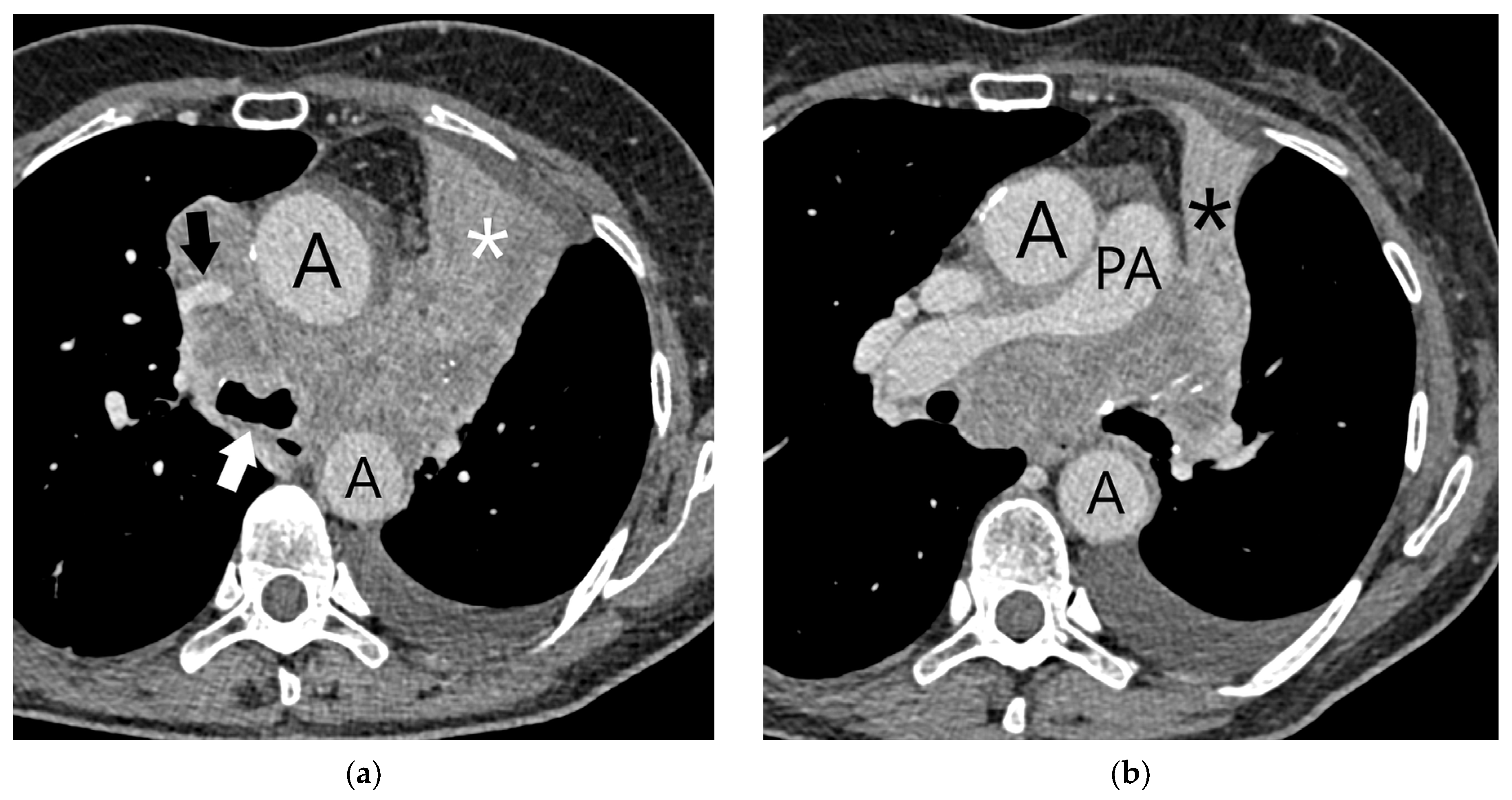 Diagnostics 15 00908 g013