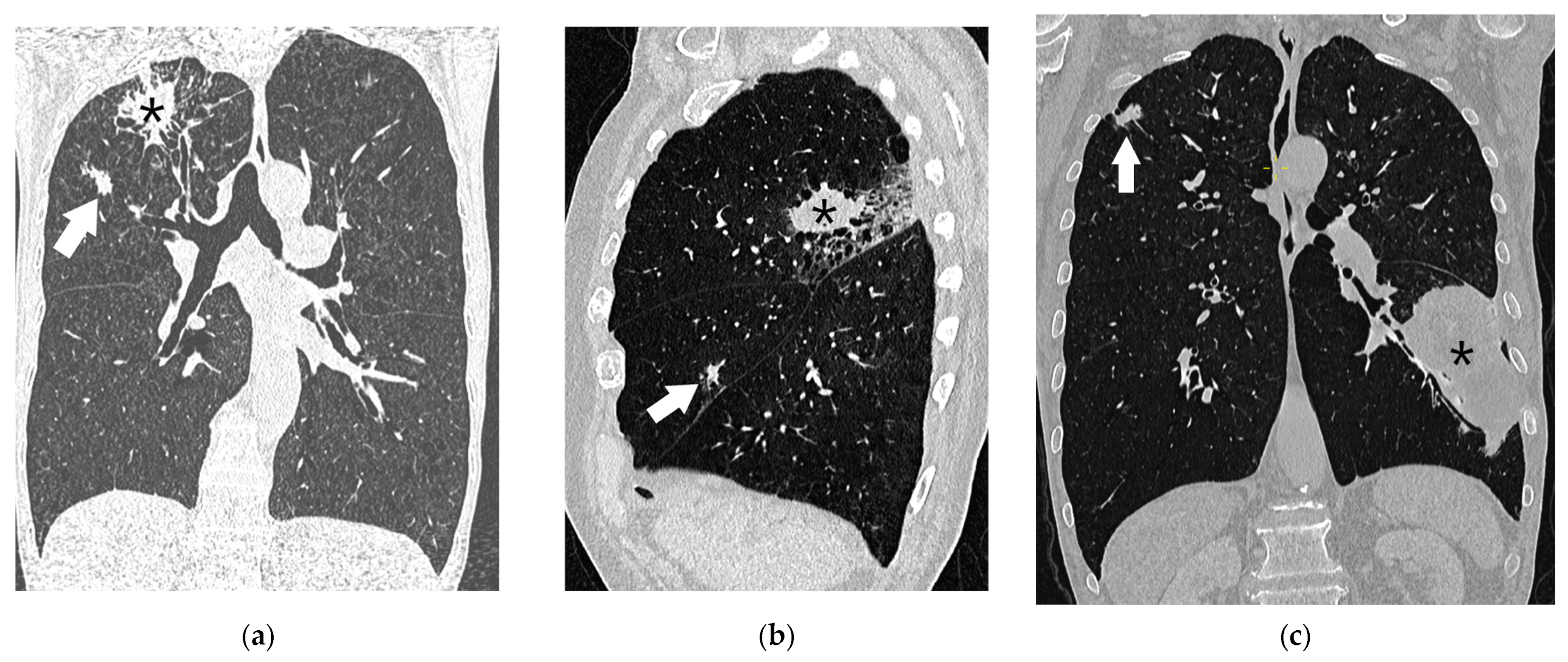 Diagnostics 15 00908 g015