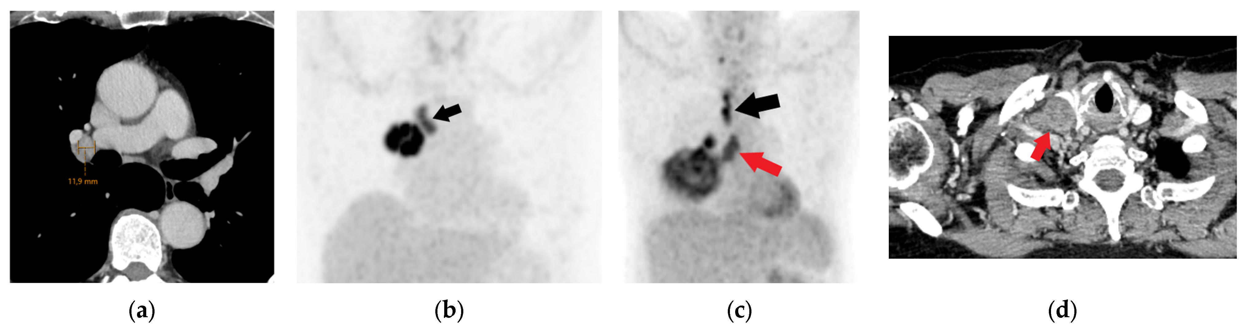 Diagnostics 15 00908 g016