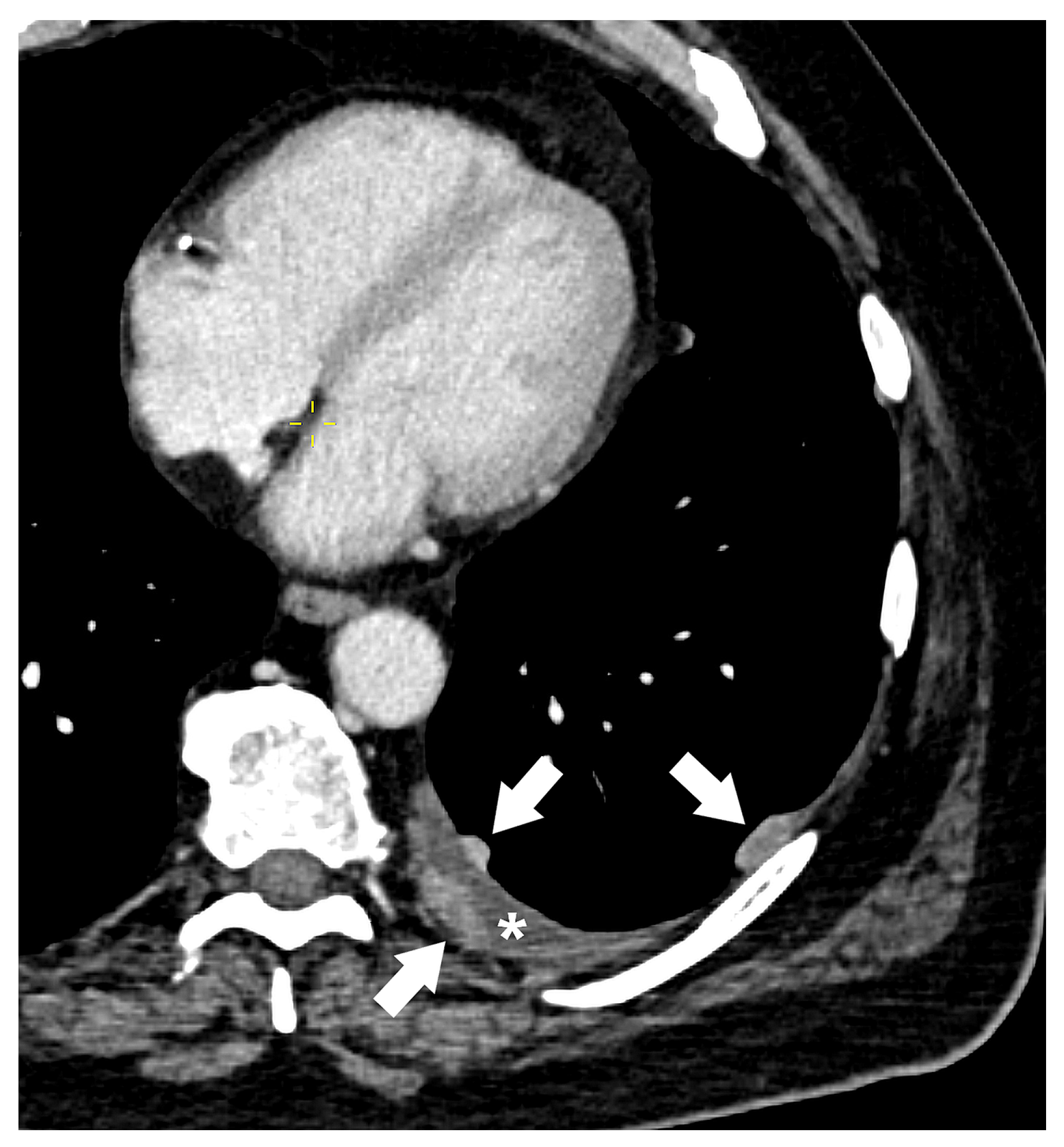 Diagnostics 15 00908 g017
