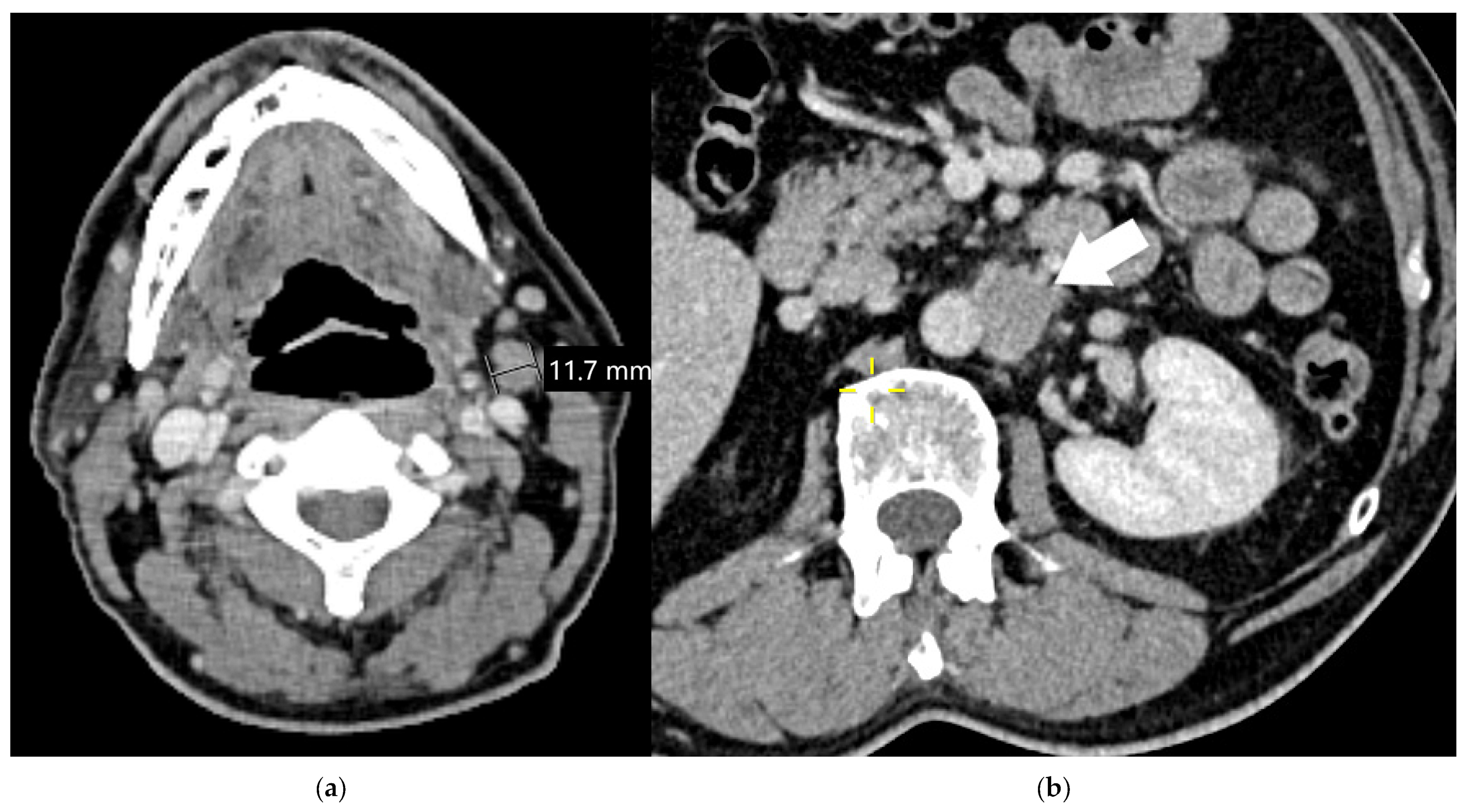 Diagnostics 15 00908 g018