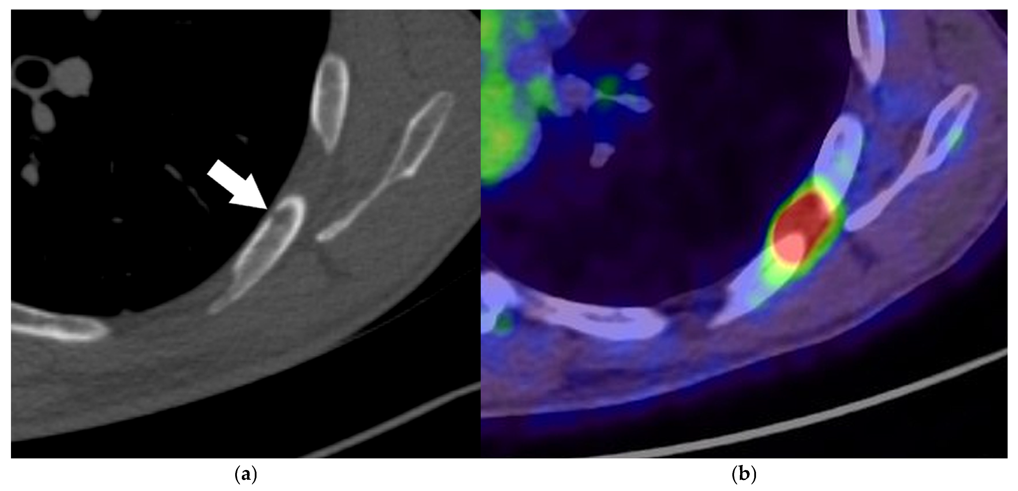 Diagnostics 15 00908 g021