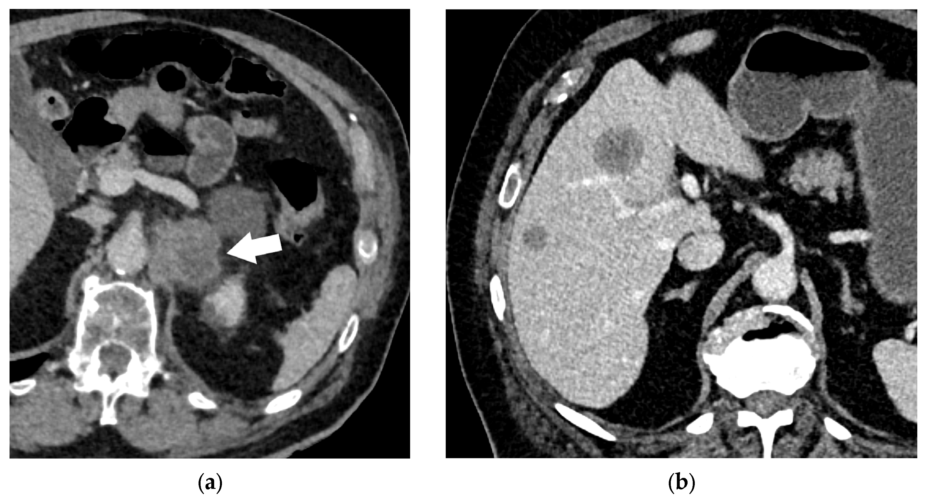 Diagnostics 15 00908 g022