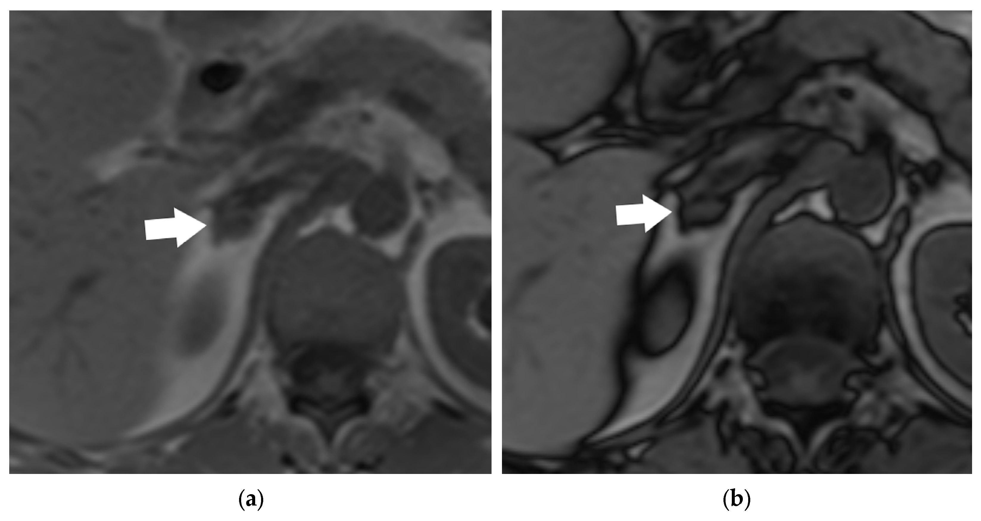 Diagnostics 15 00908 g023
