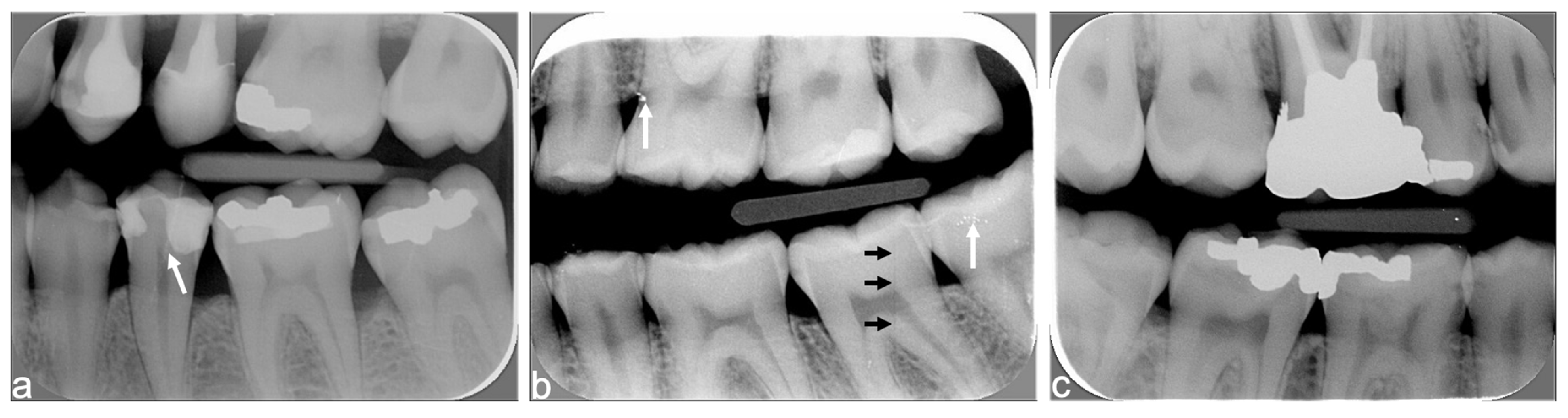 Diagnostics 15 00911 g009