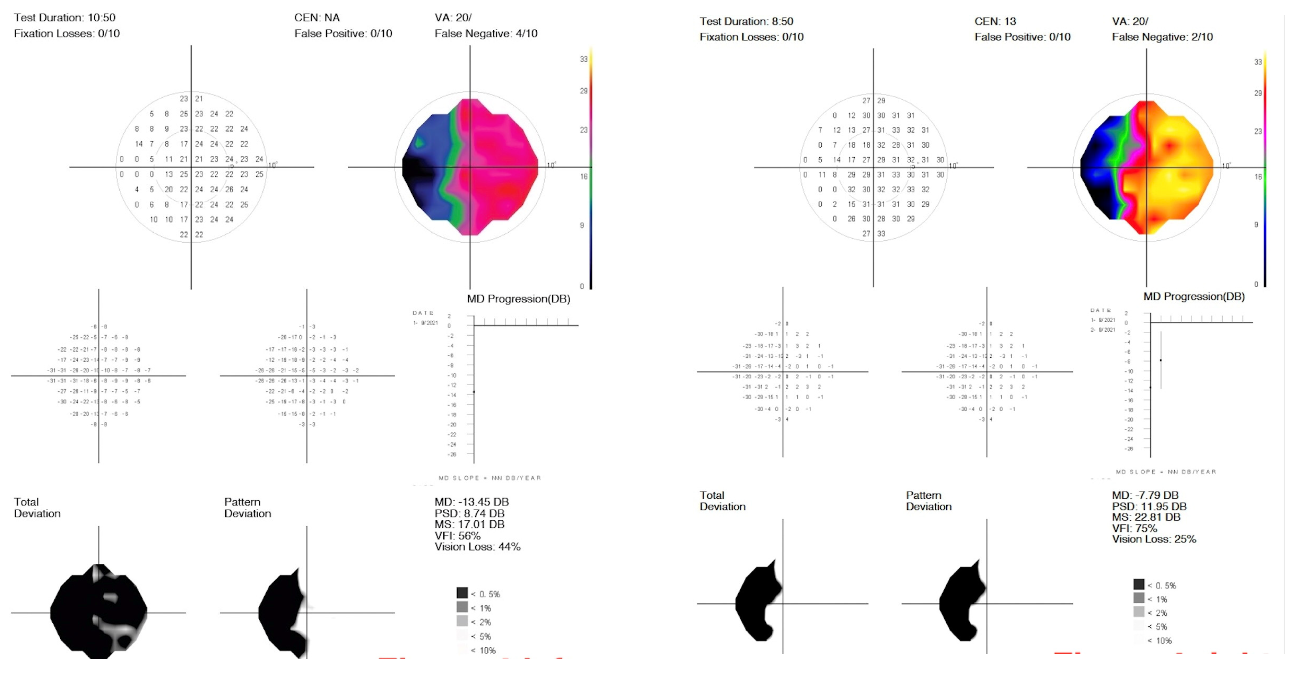 Diagnostics 15 00912 g004
