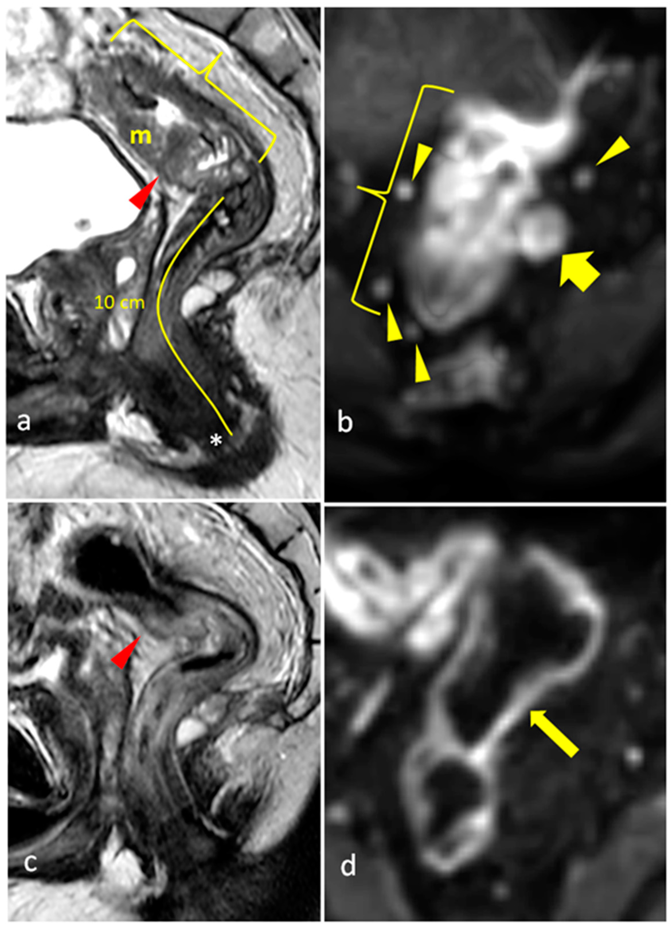 Diagnostics 15 00913 g003