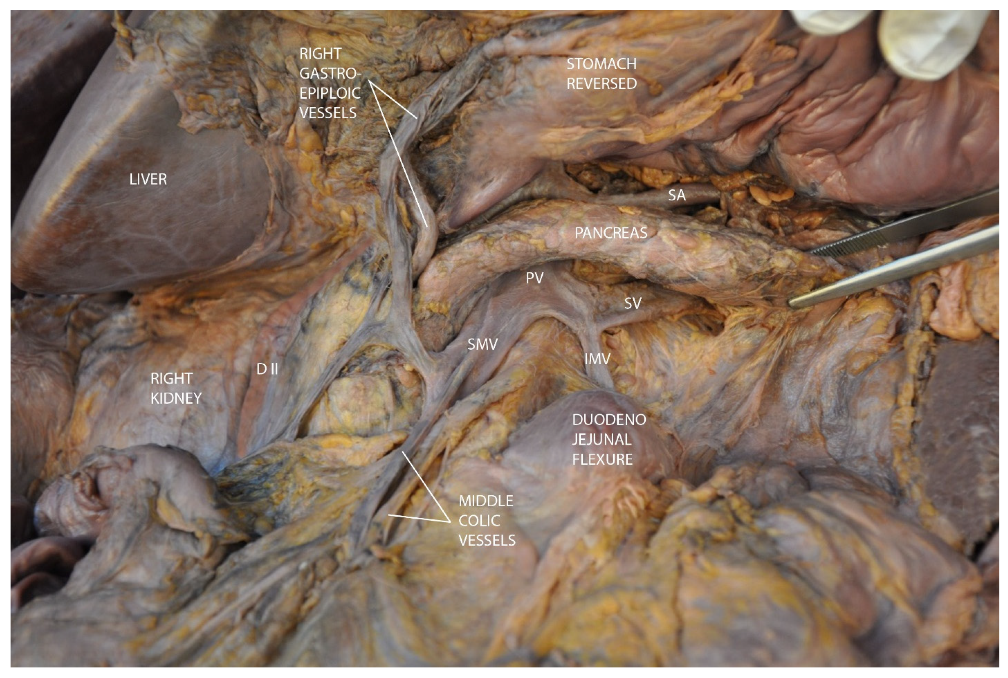Diagnostics 15 00914 g003