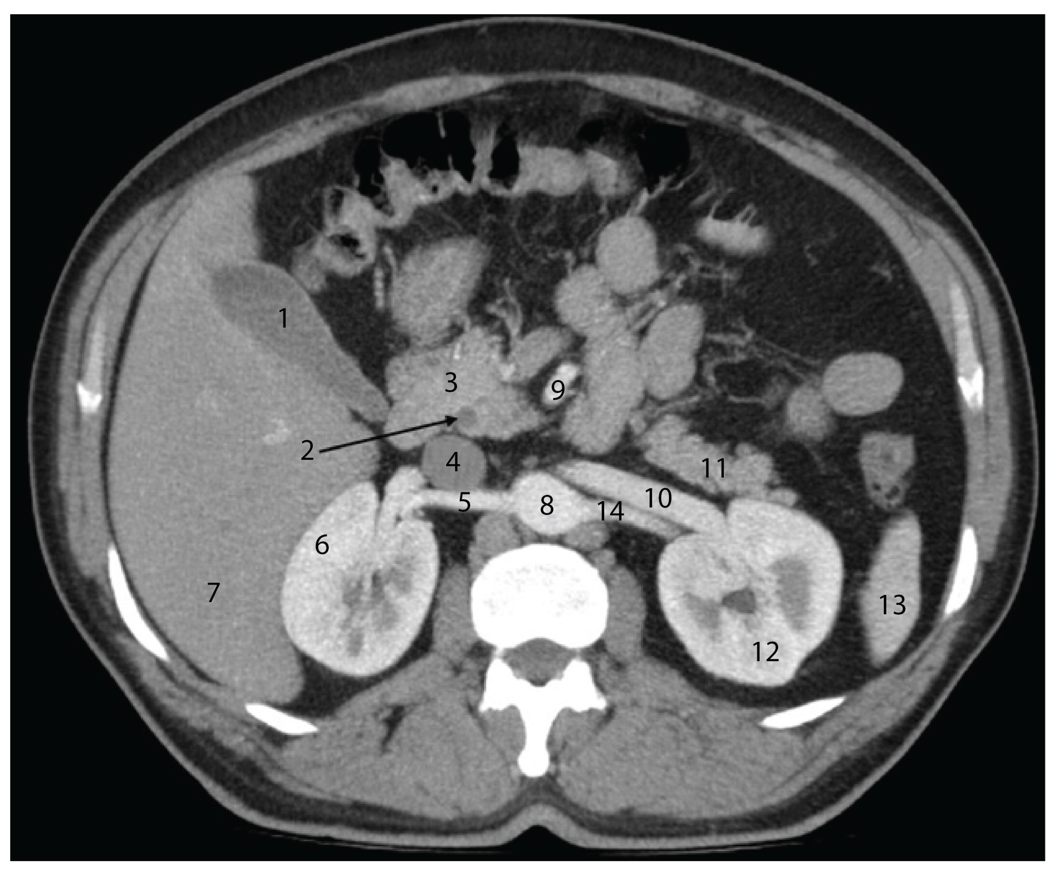 Diagnostics 15 00914 g004