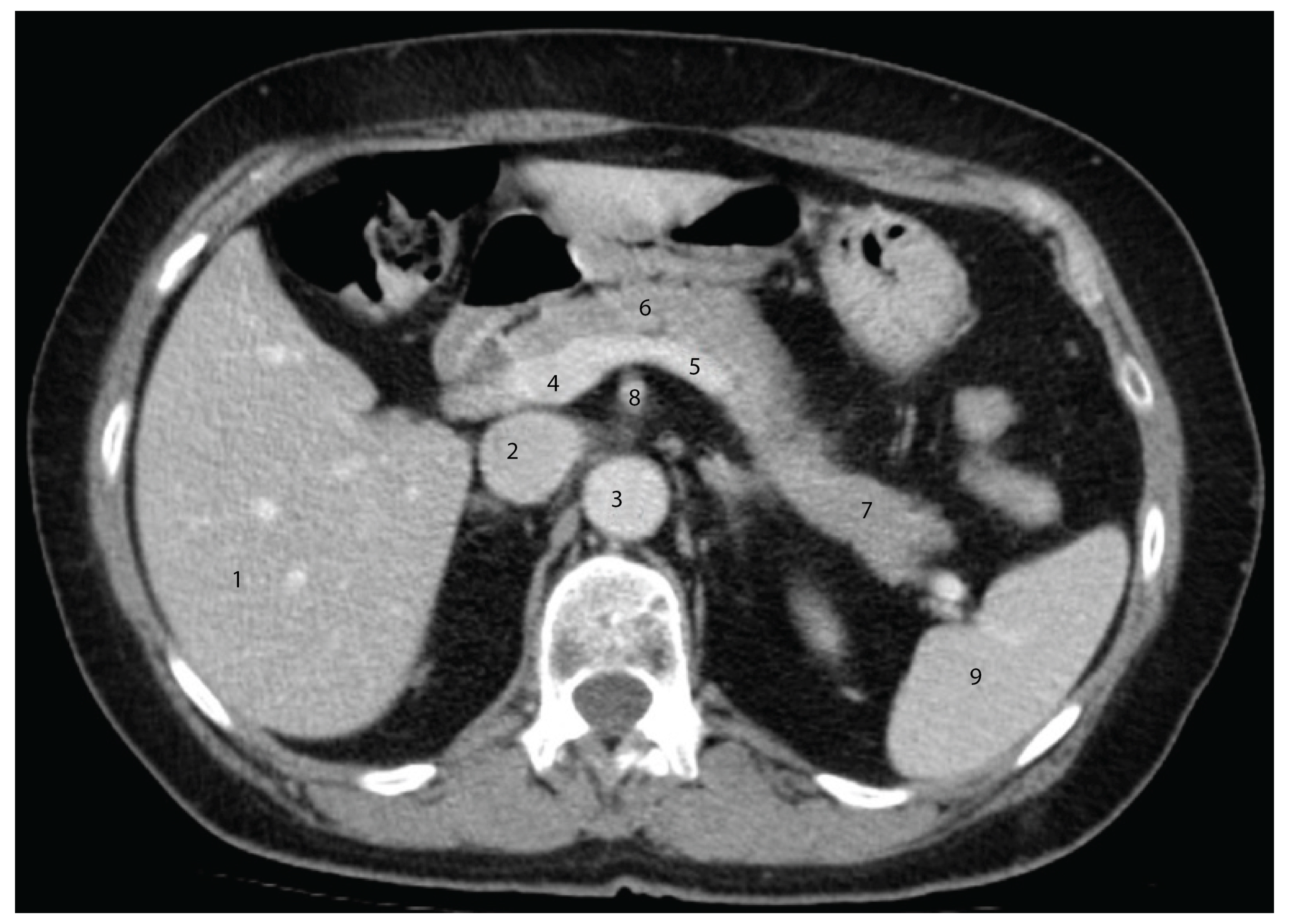 Diagnostics 15 00914 g005