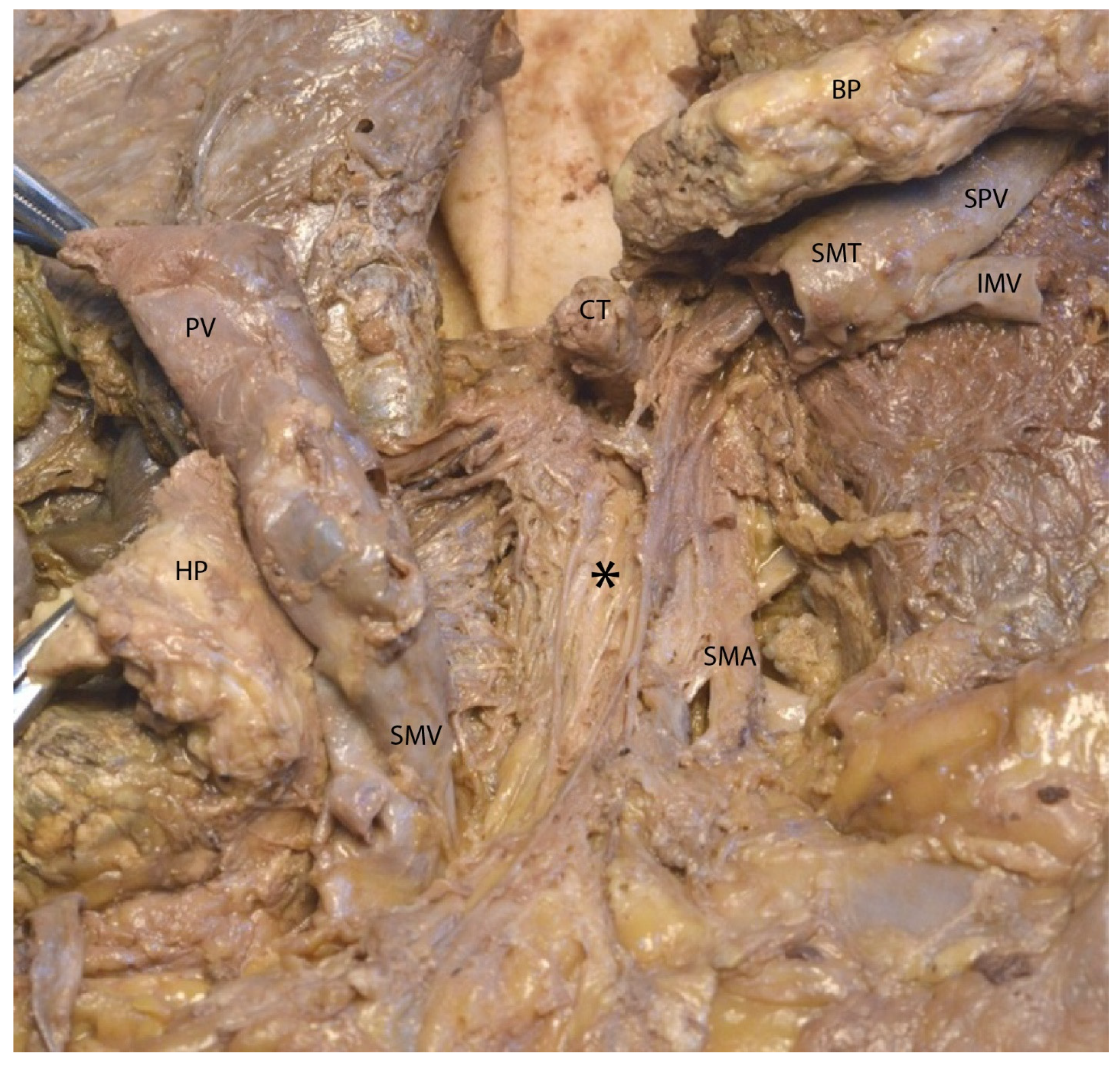 Diagnostics 15 00914 g008