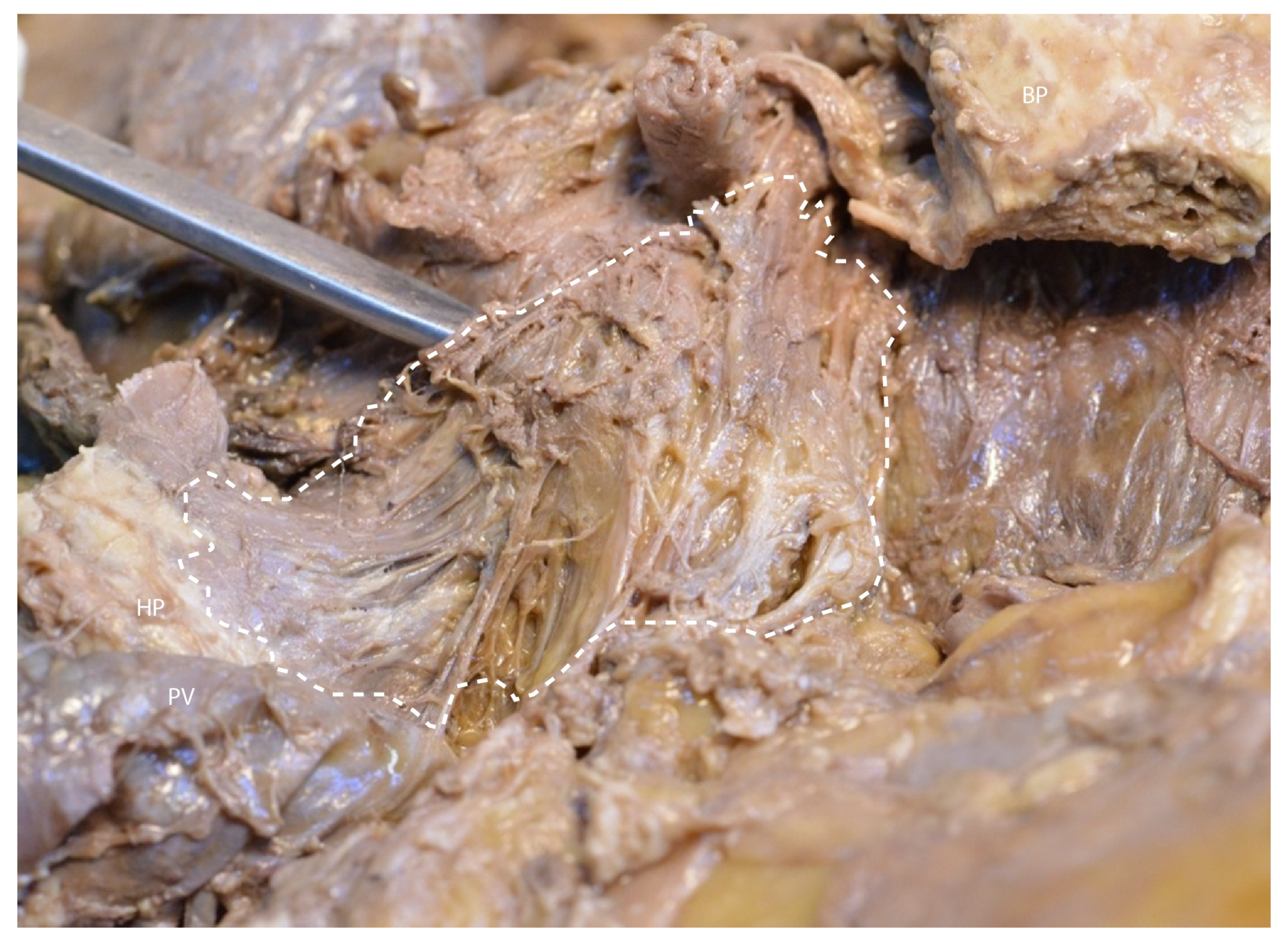 Diagnostics 15 00914 g010