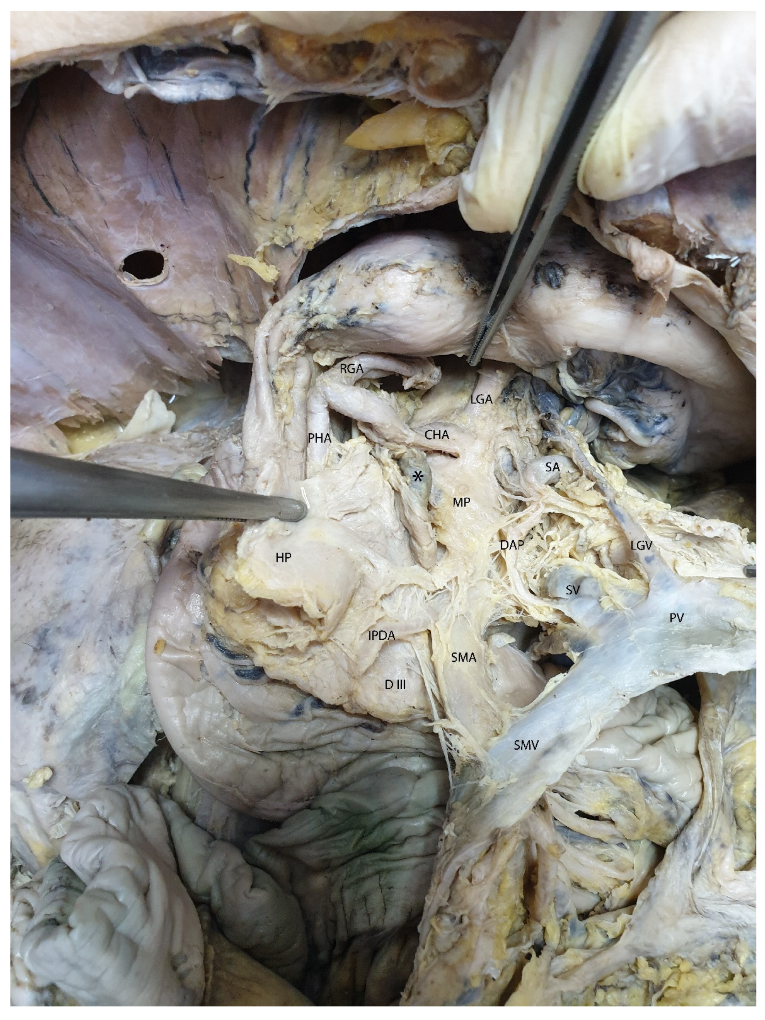 Diagnostics 15 00914 g011