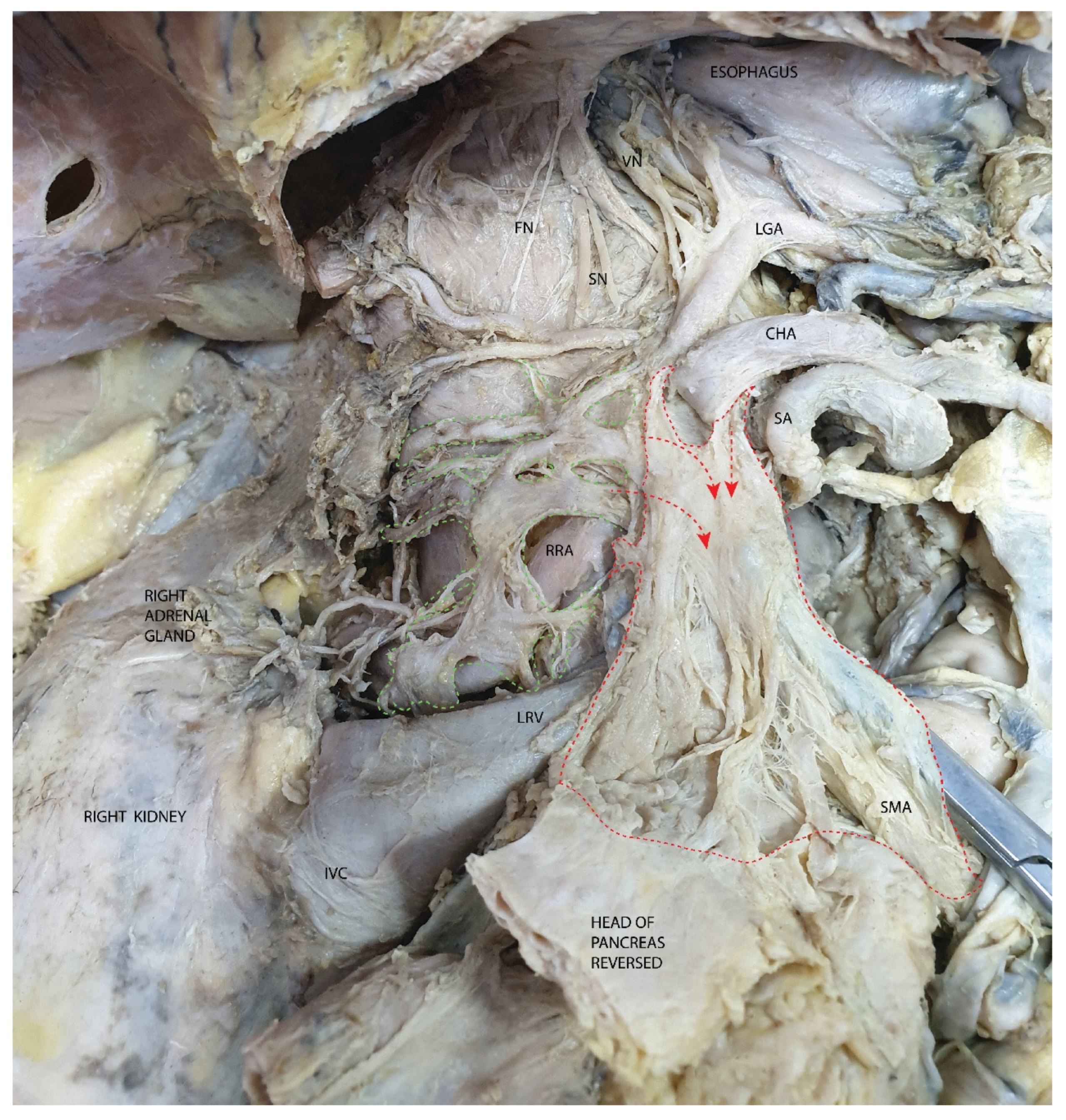 Diagnostics 15 00914 g013