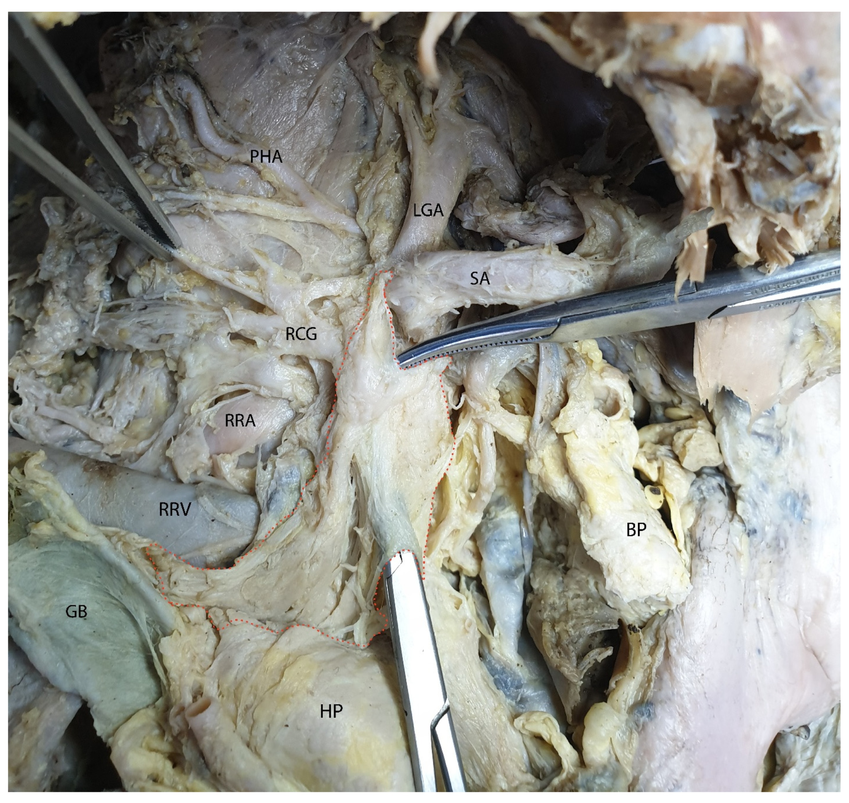 Diagnostics 15 00914 g014