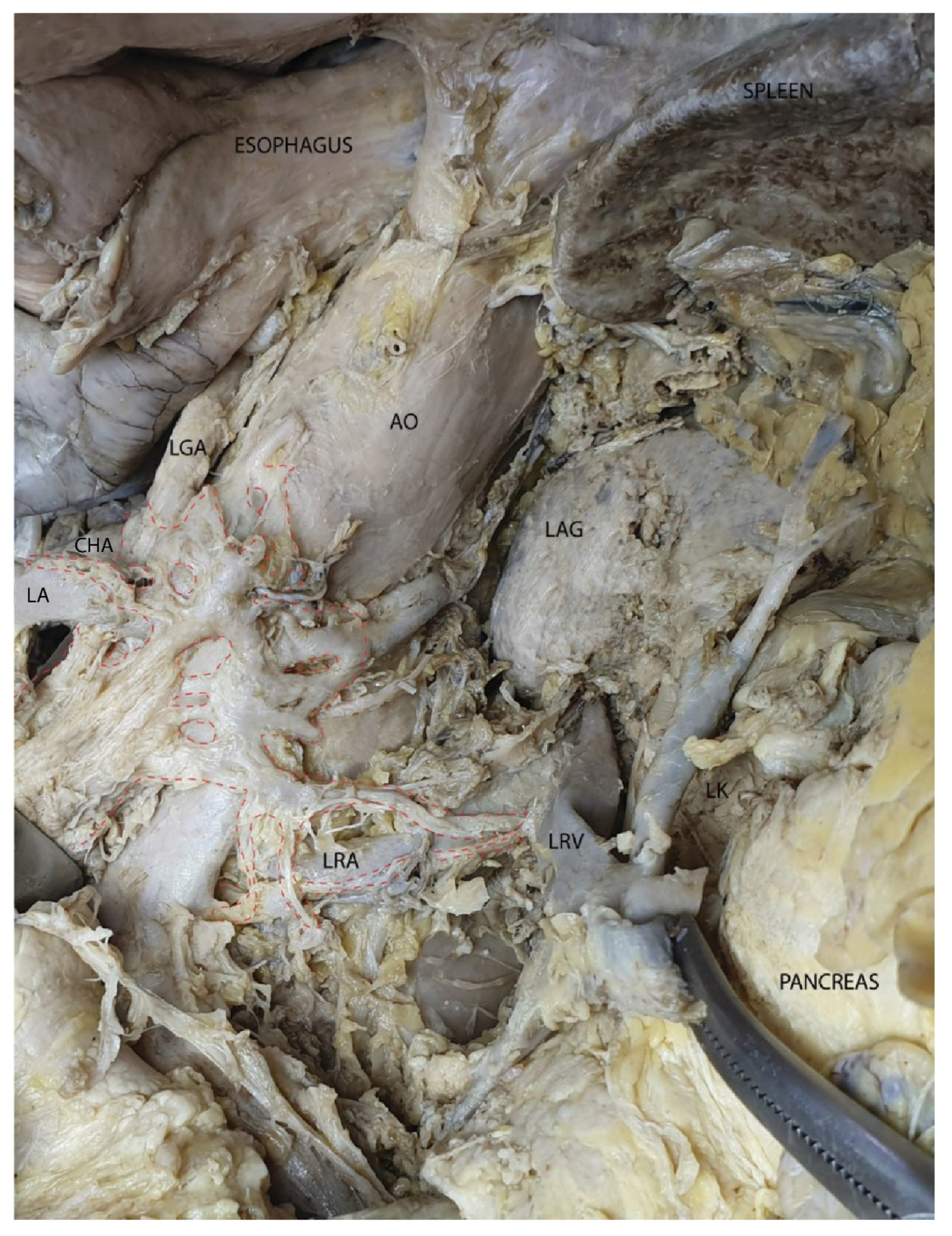 Diagnostics 15 00914 g015