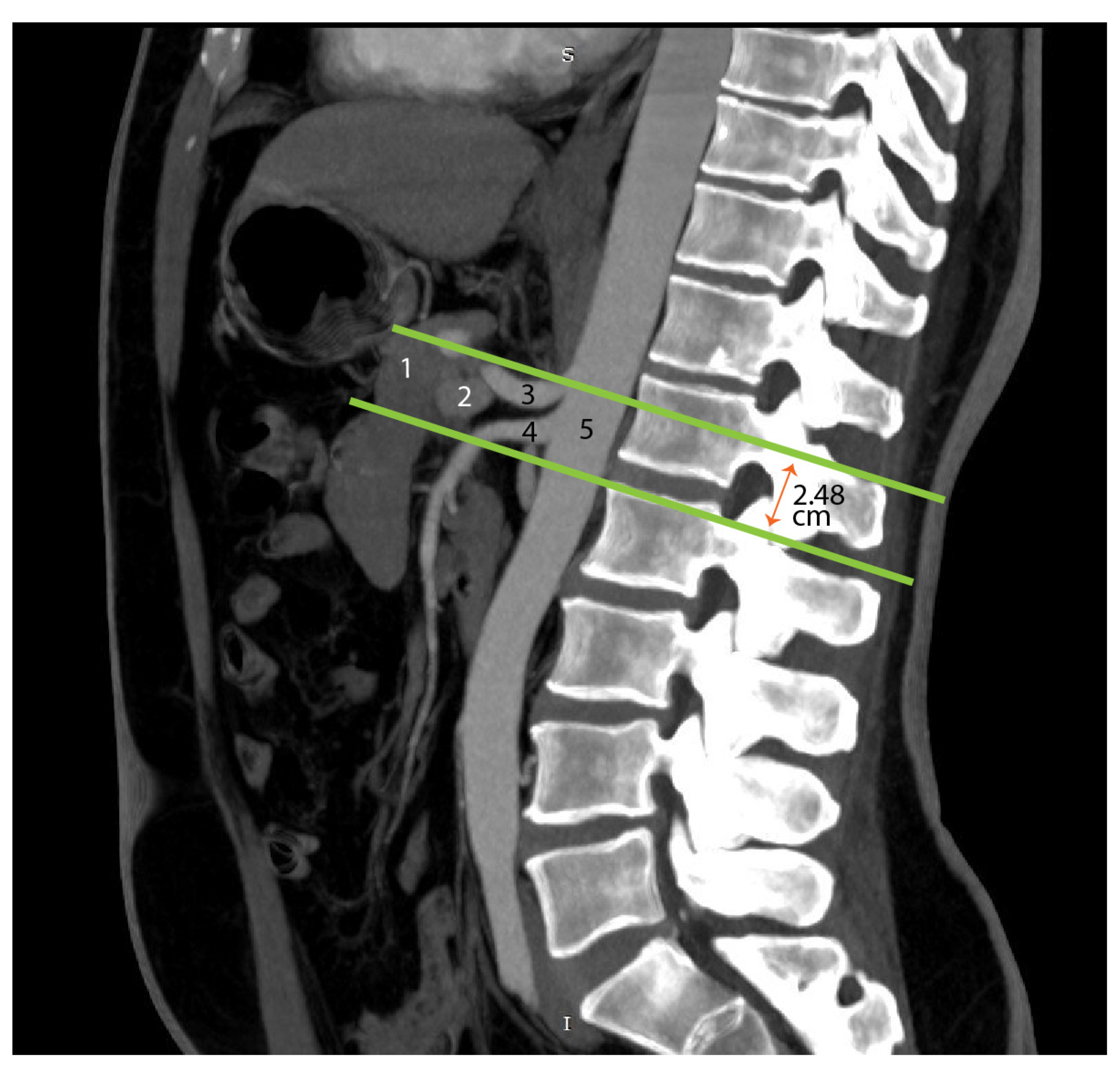 Diagnostics 15 00914 g017