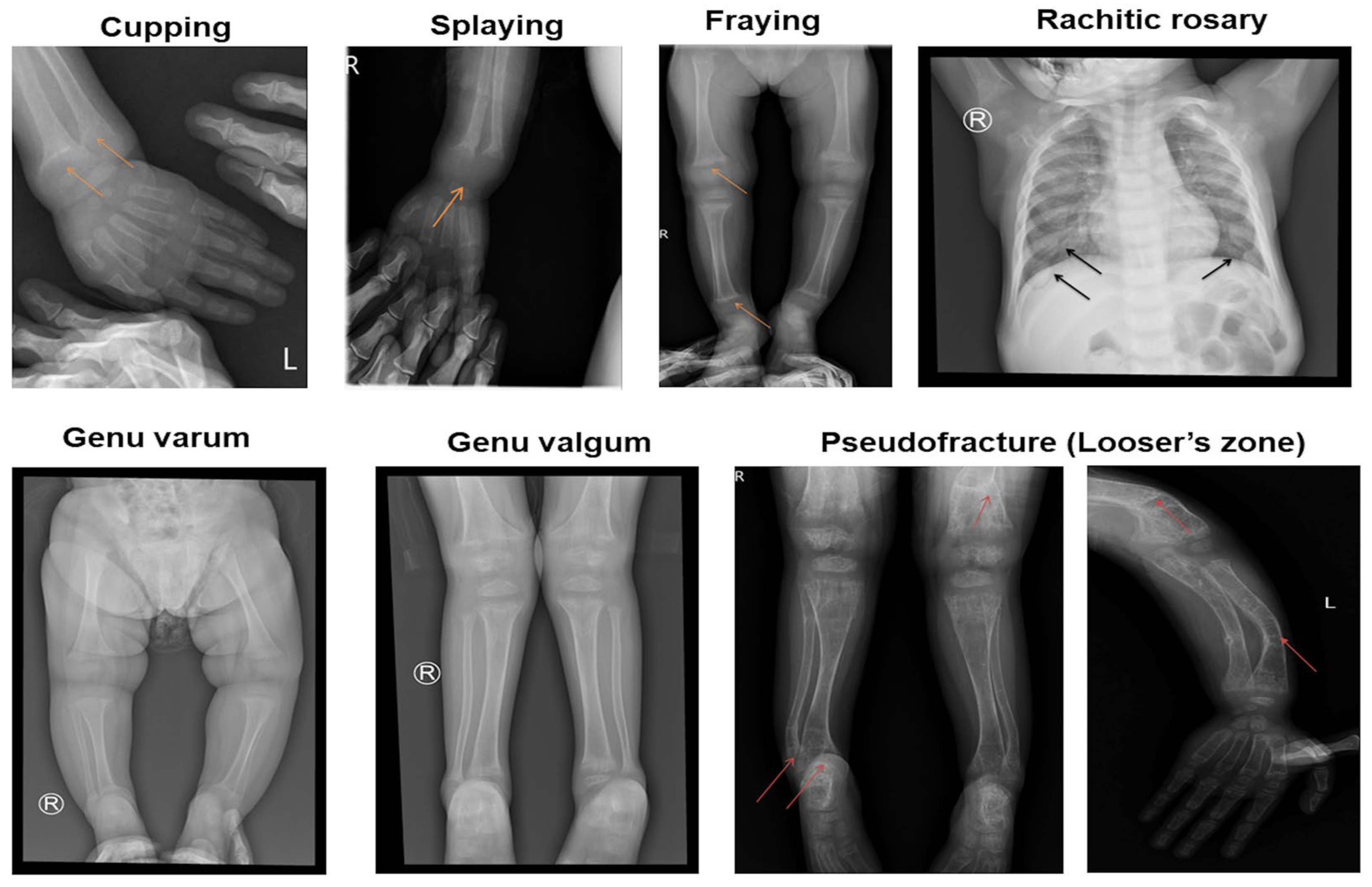 Diagnostics 15 00918 g002
