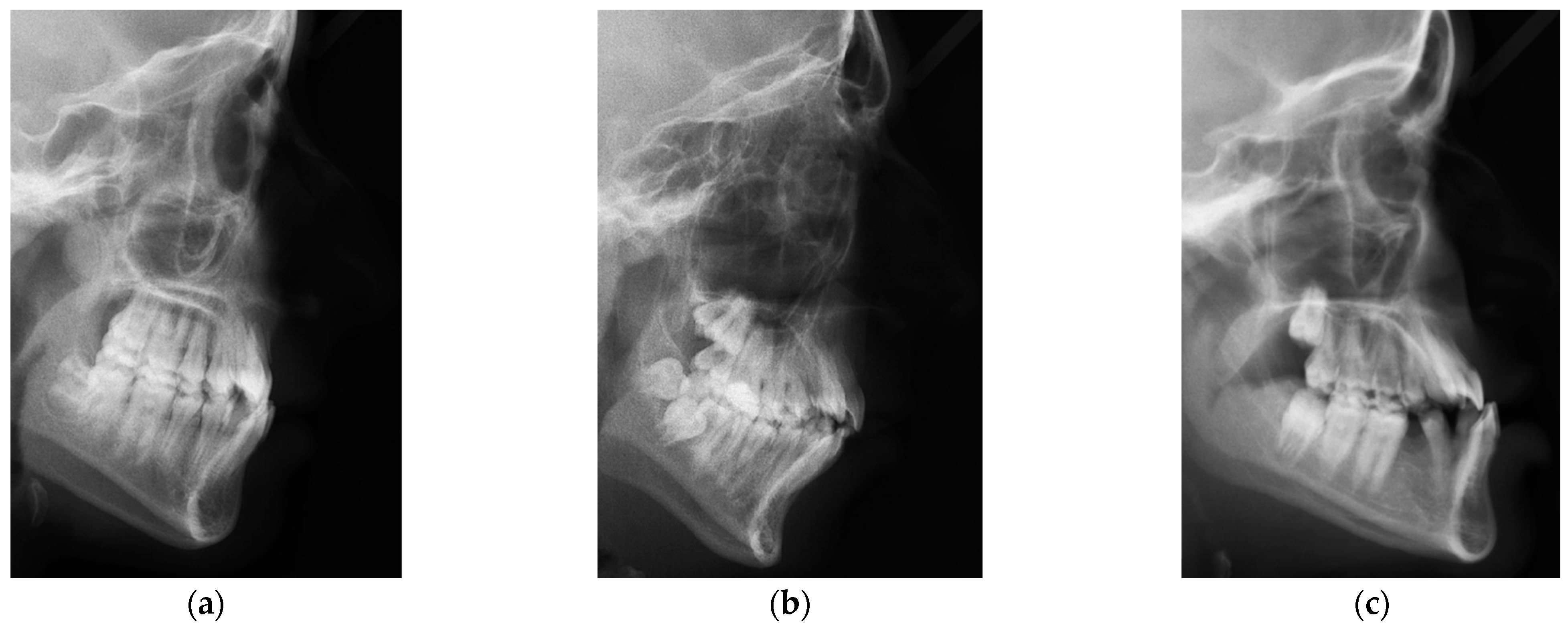 Diagnostics 15 00920 g001