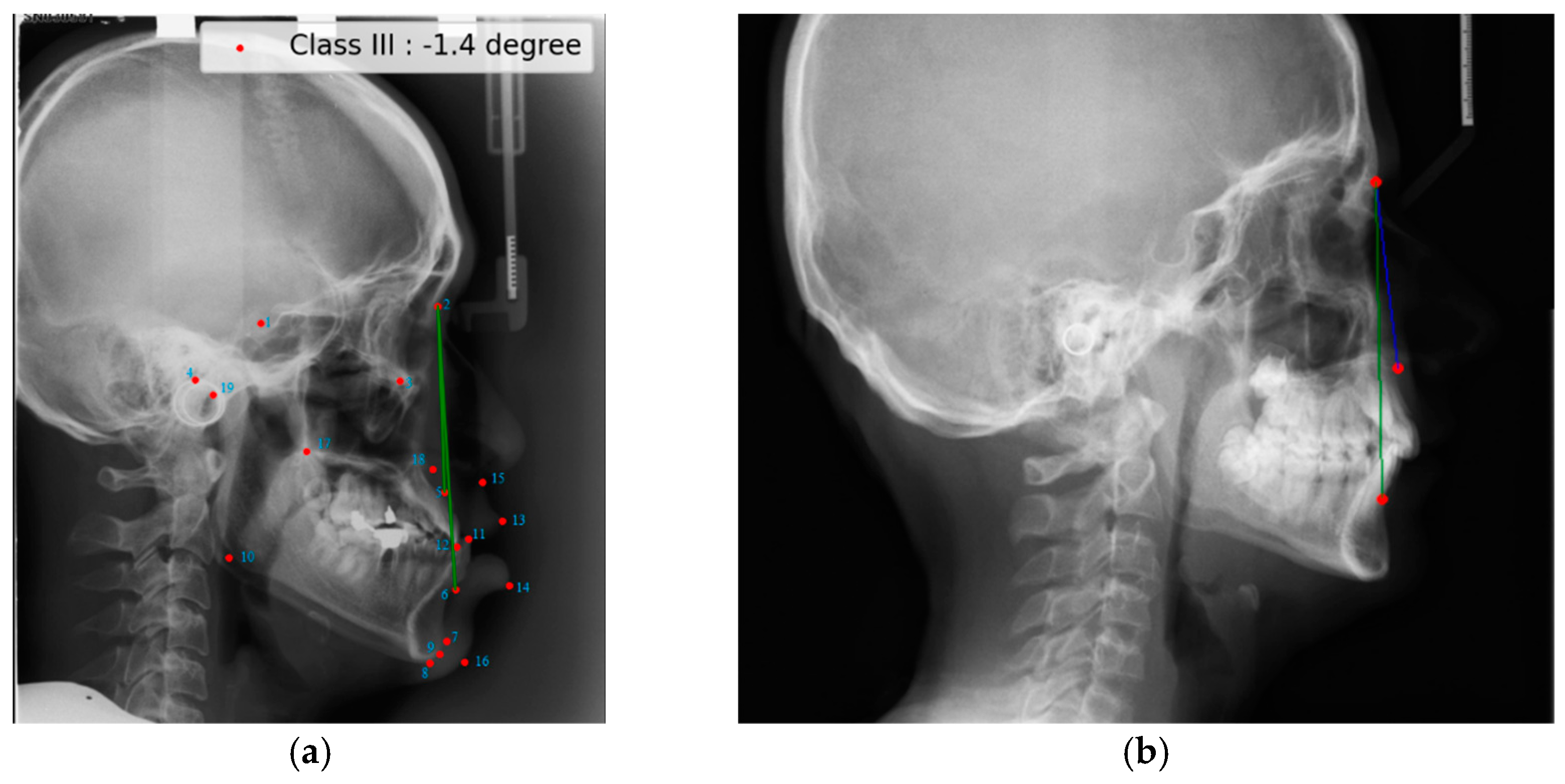 Diagnostics 15 00920 g002