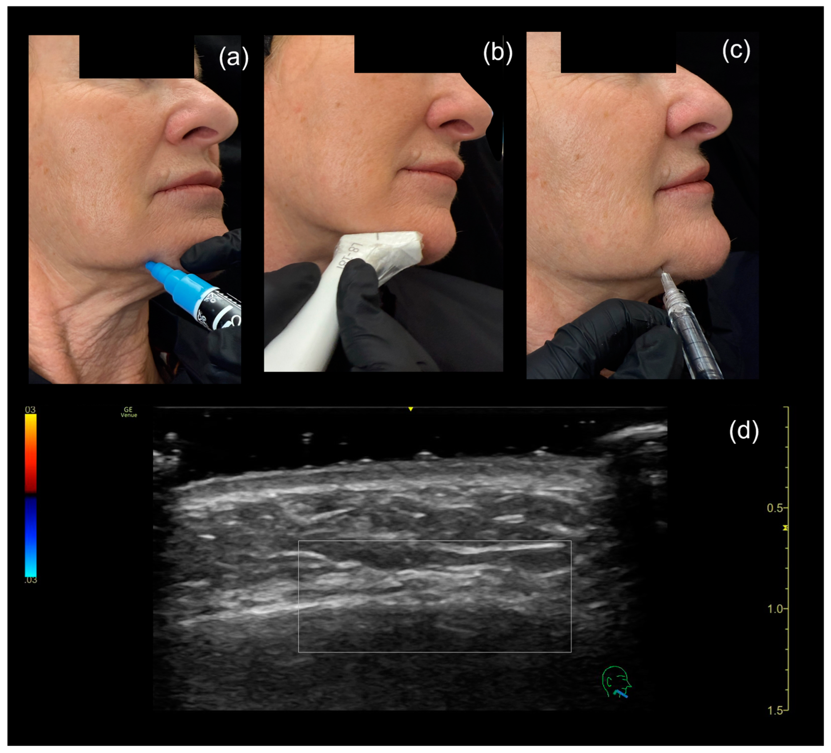 Diagnostics 15 00921 g006