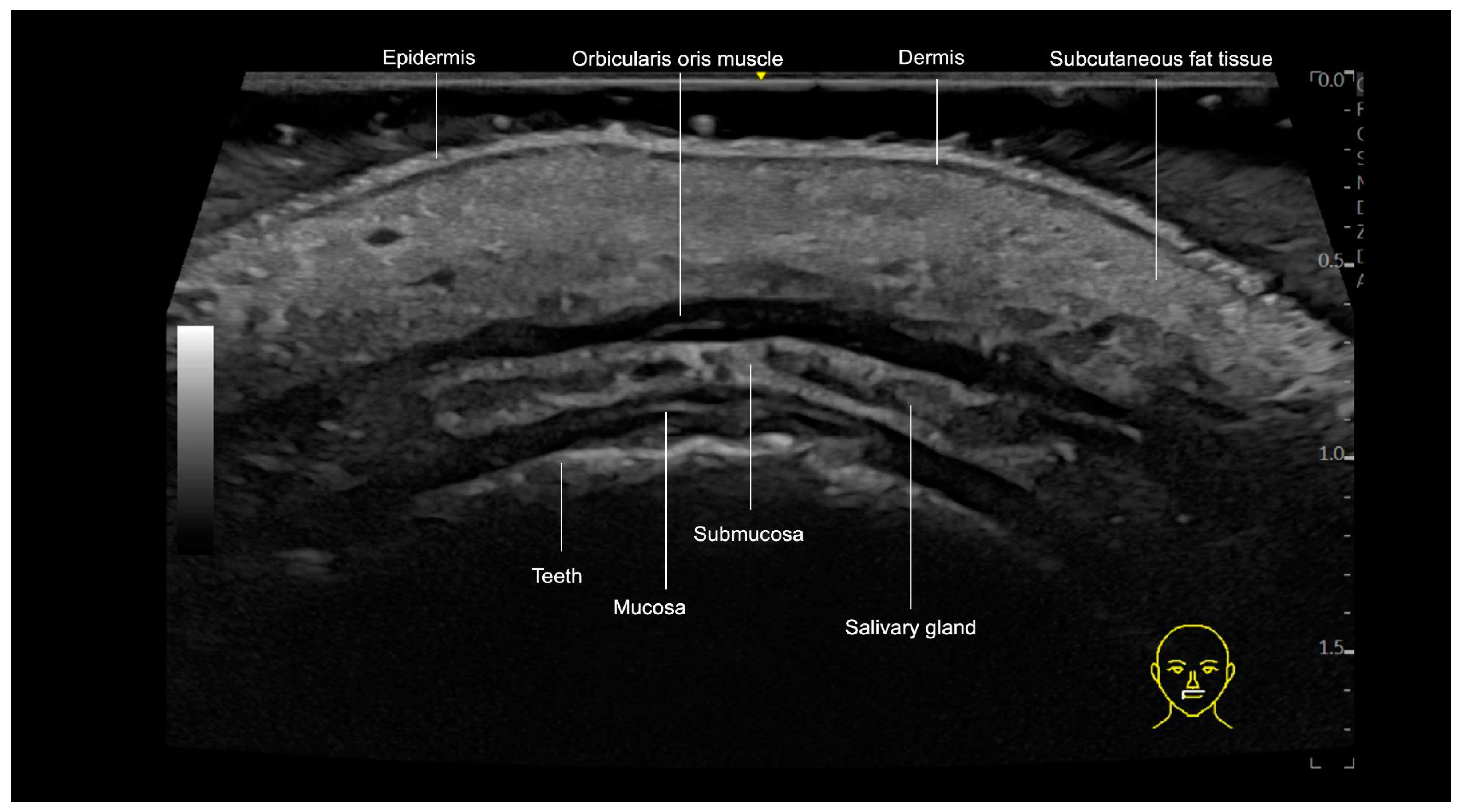 Diagnostics 15 00921 g011