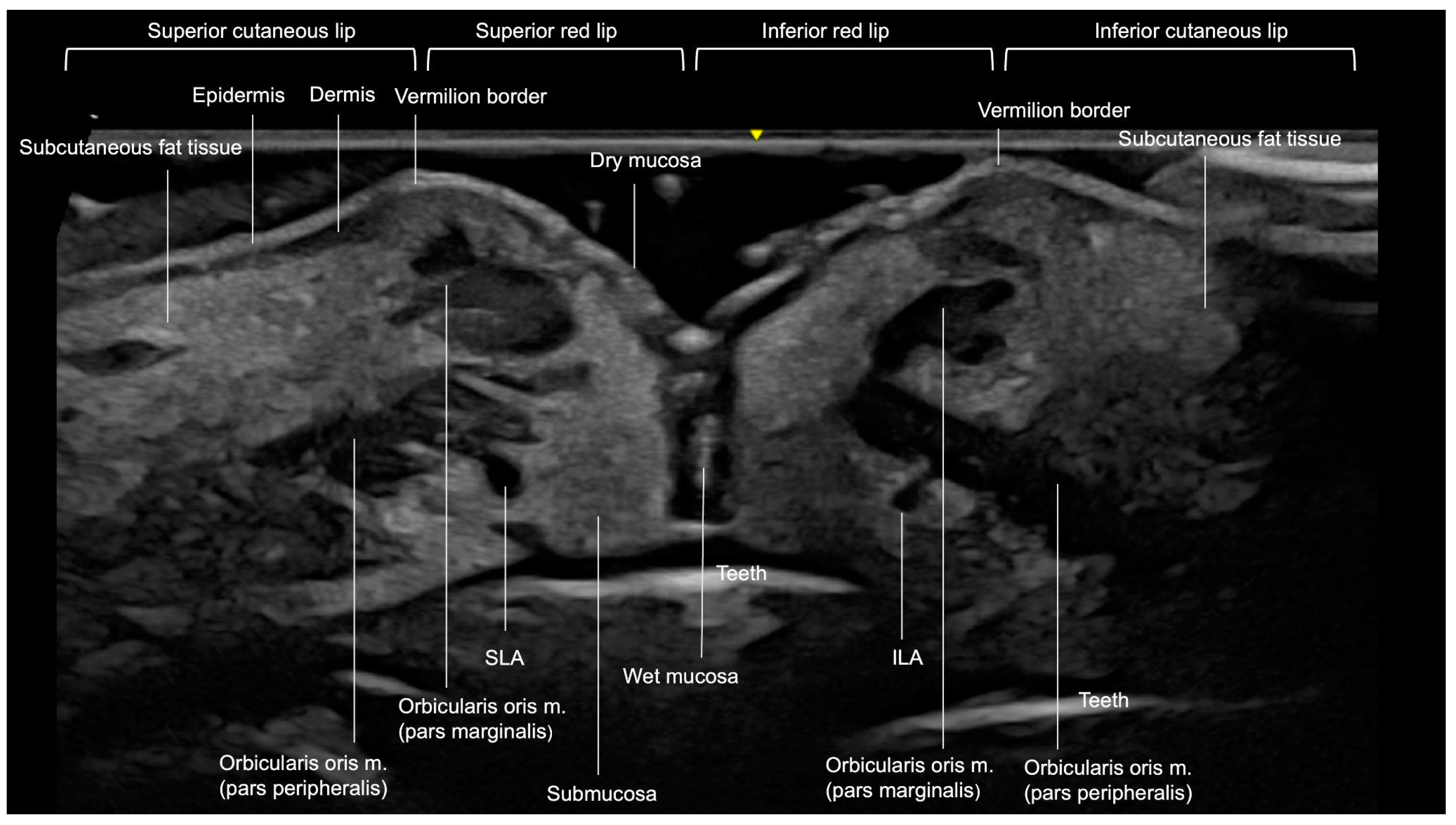 Diagnostics 15 00921 g012