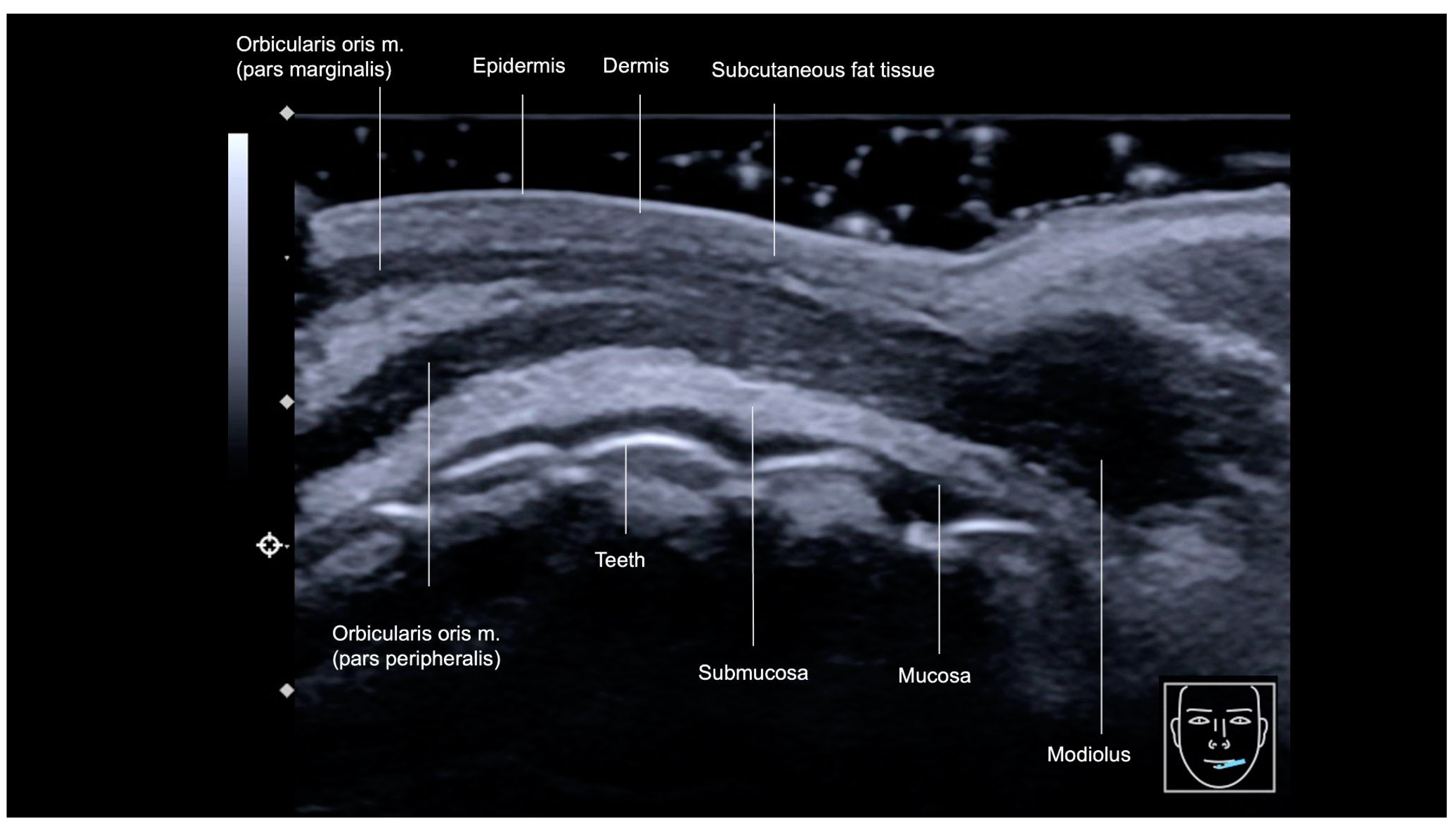 Diagnostics 15 00921 g013