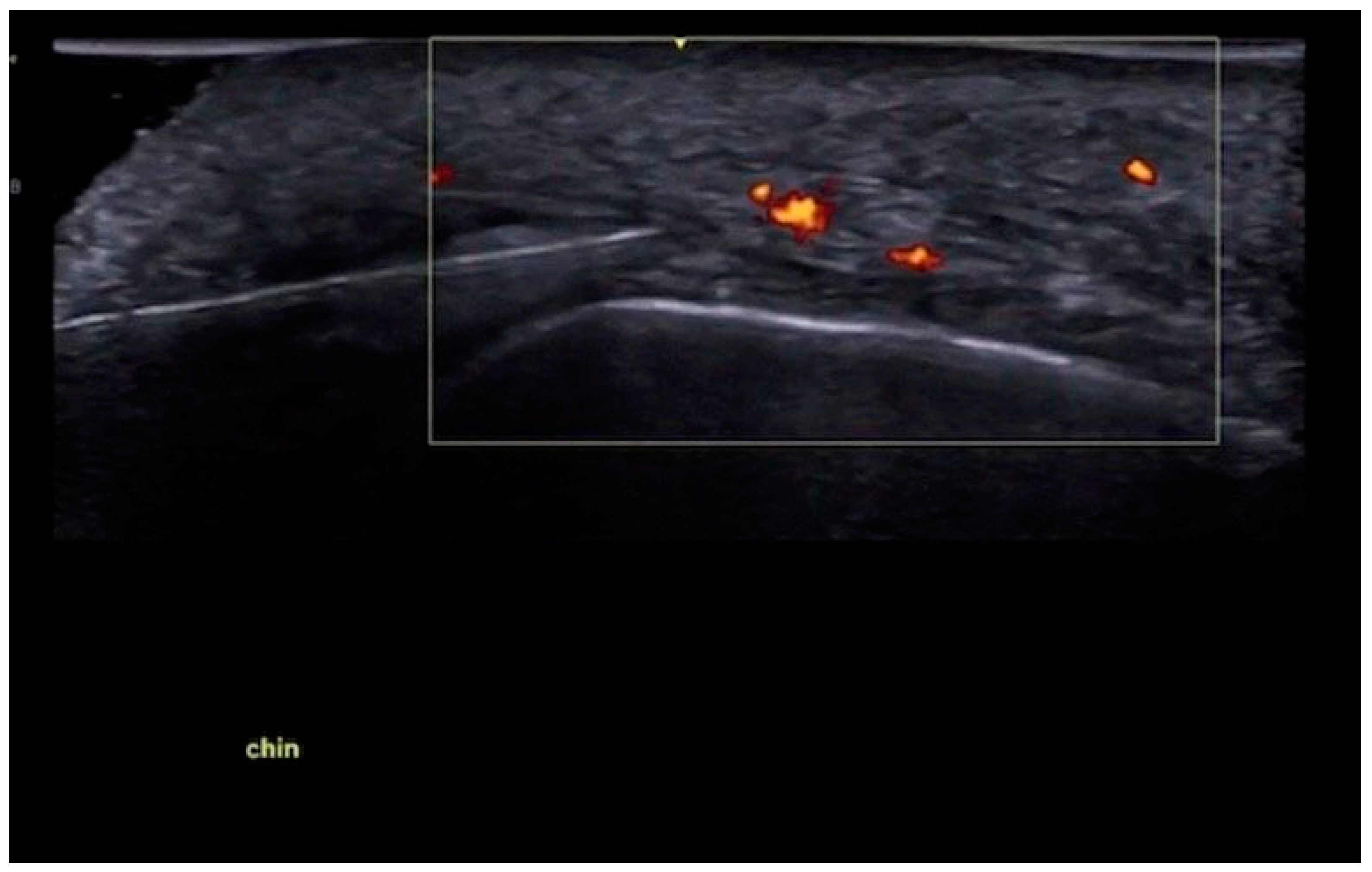 Diagnostics 15 00921 g022