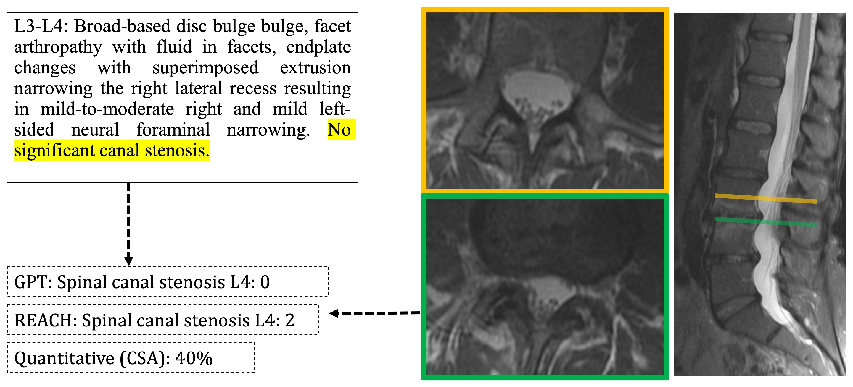 Diagnostics 15 00930 g004