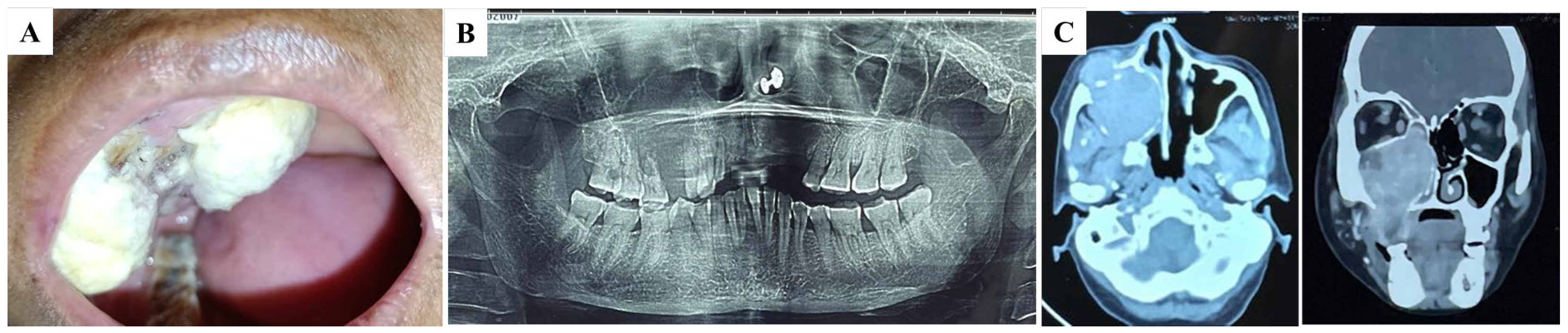 Diagnostics 15 00938 g001
