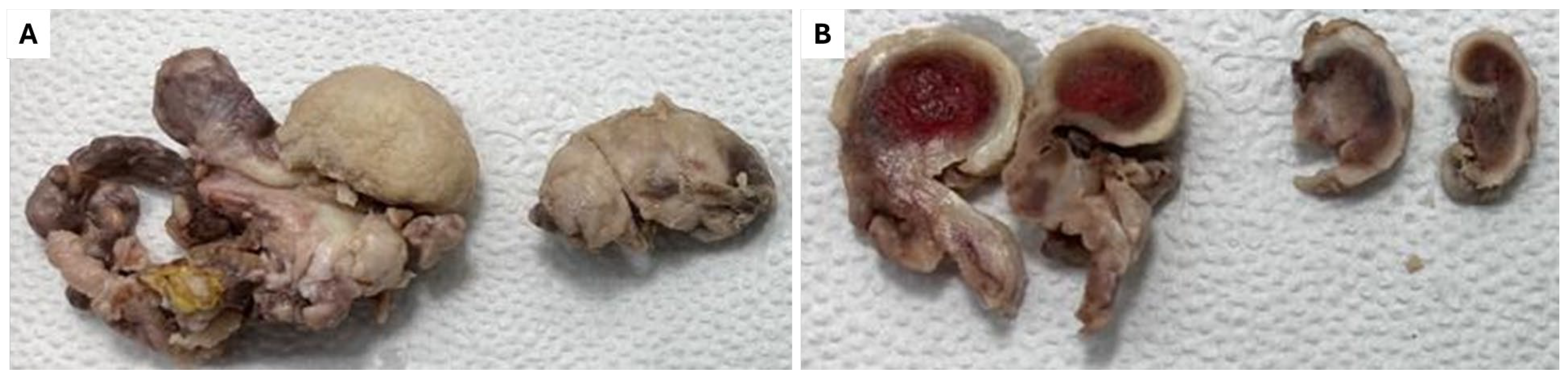 Diagnostics 15 00938 g004