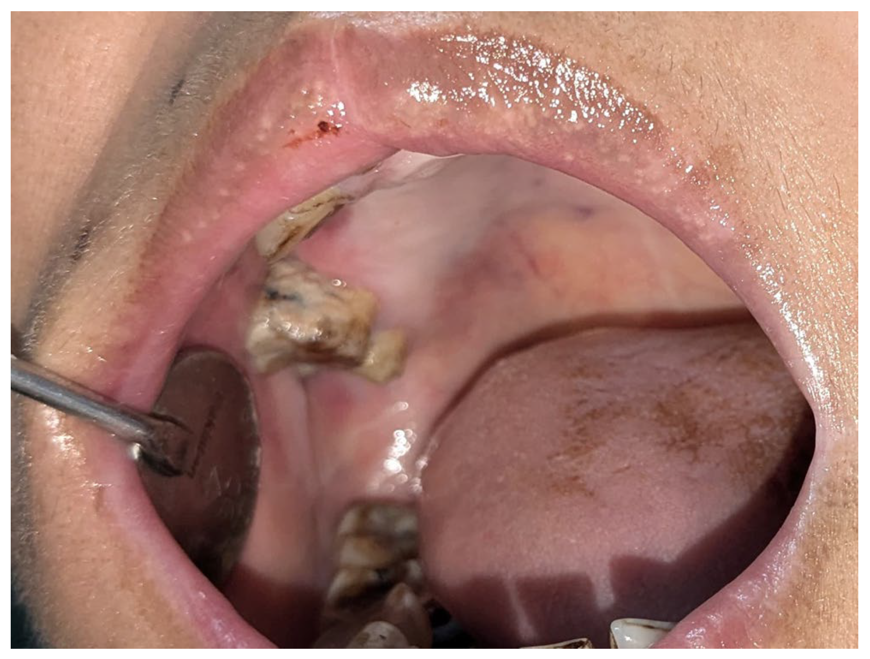 Diagnostics 15 00938 g006