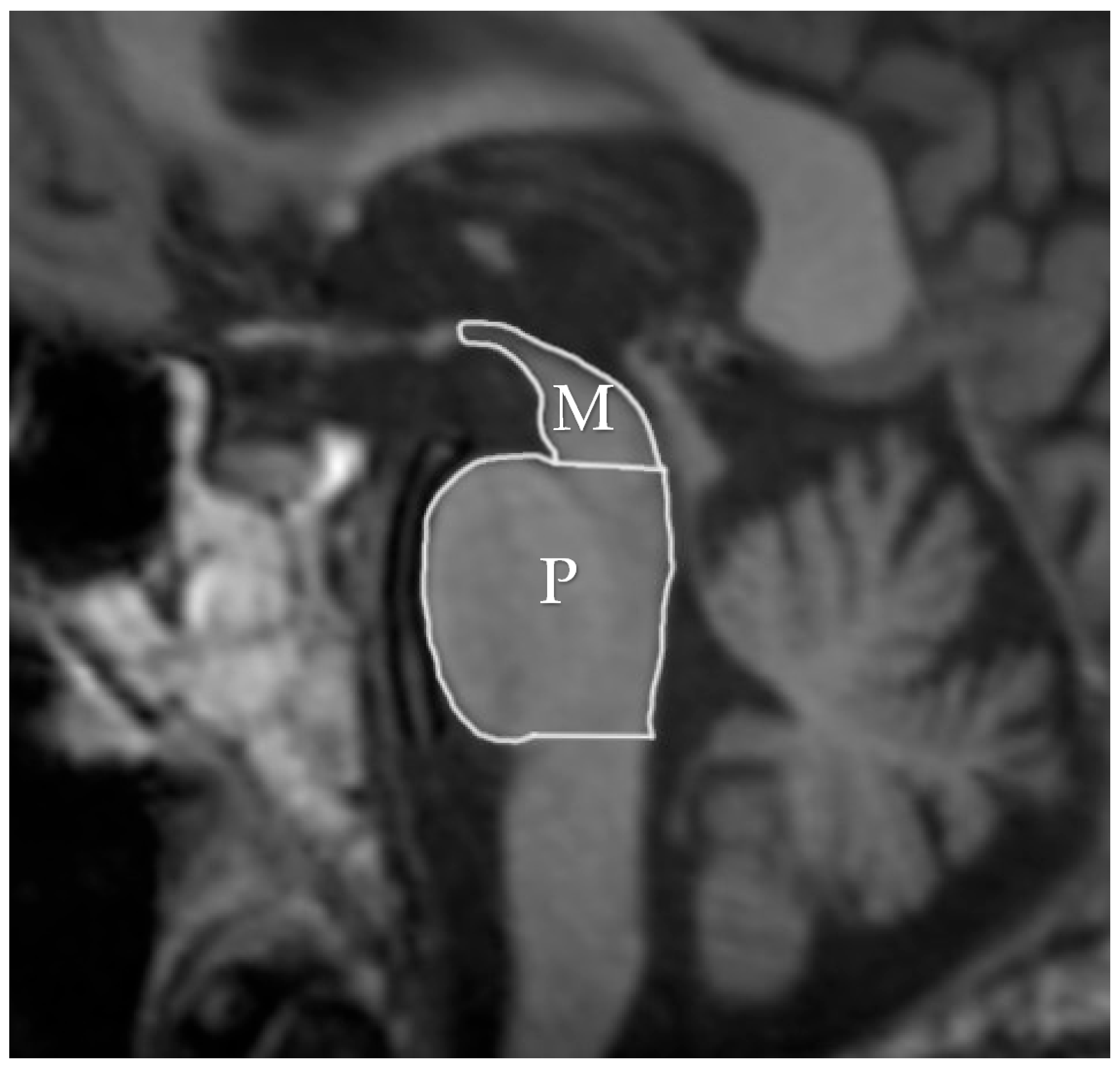Diagnostics 15 00945 g001 Diagnostics 15 00945 g001