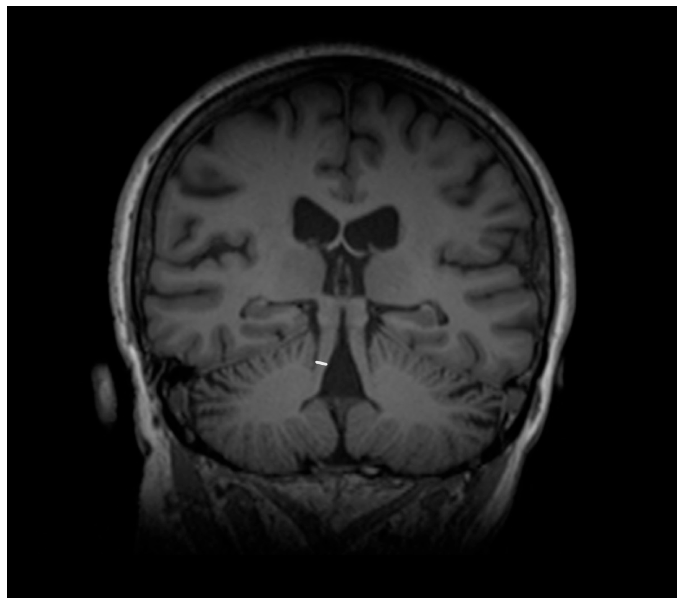 Diagnostics 15 00945 g002 Diagnostics 15 00945 g002