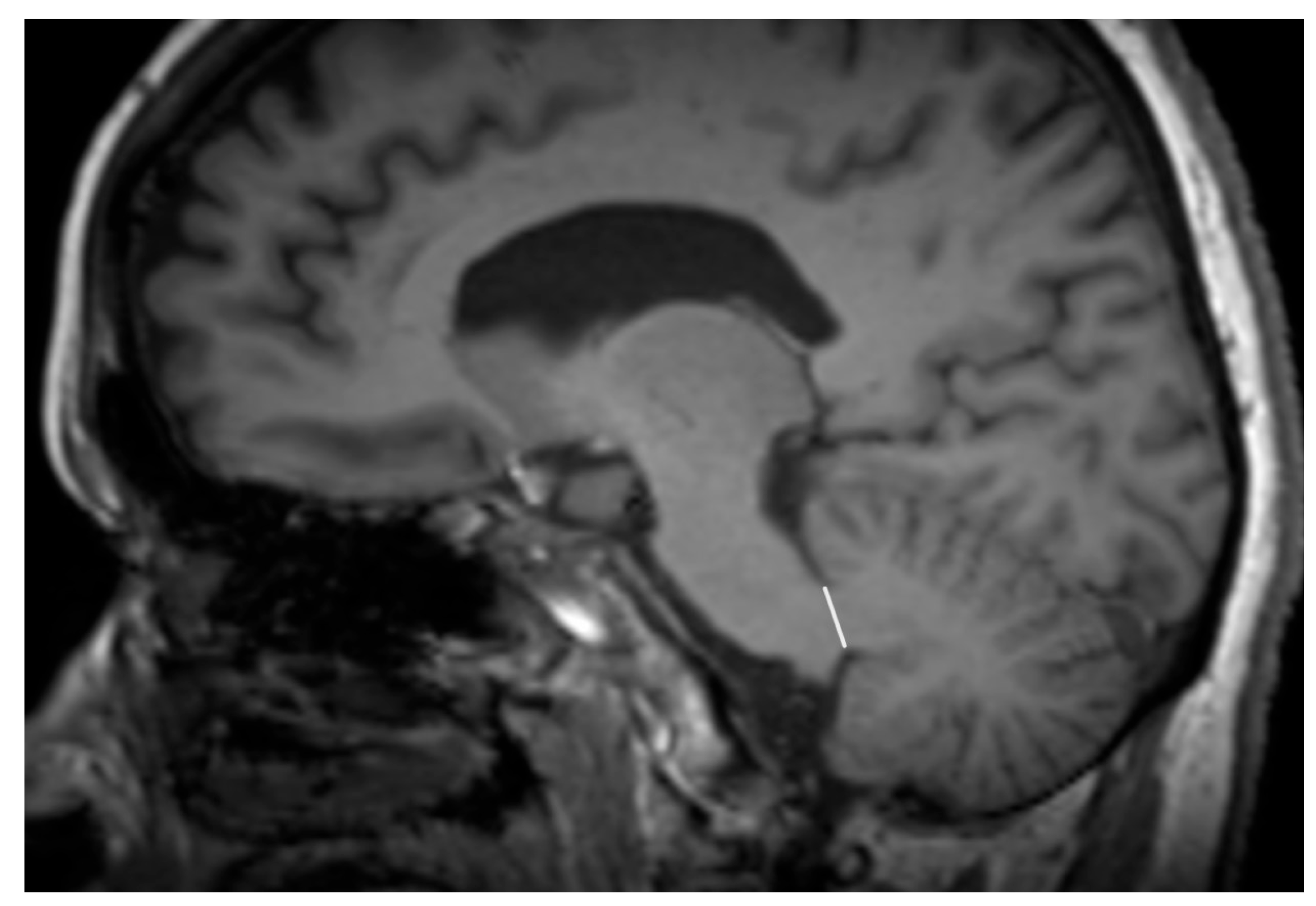 Diagnostics 15 00945 g003 Diagnostics 15 00945 g003