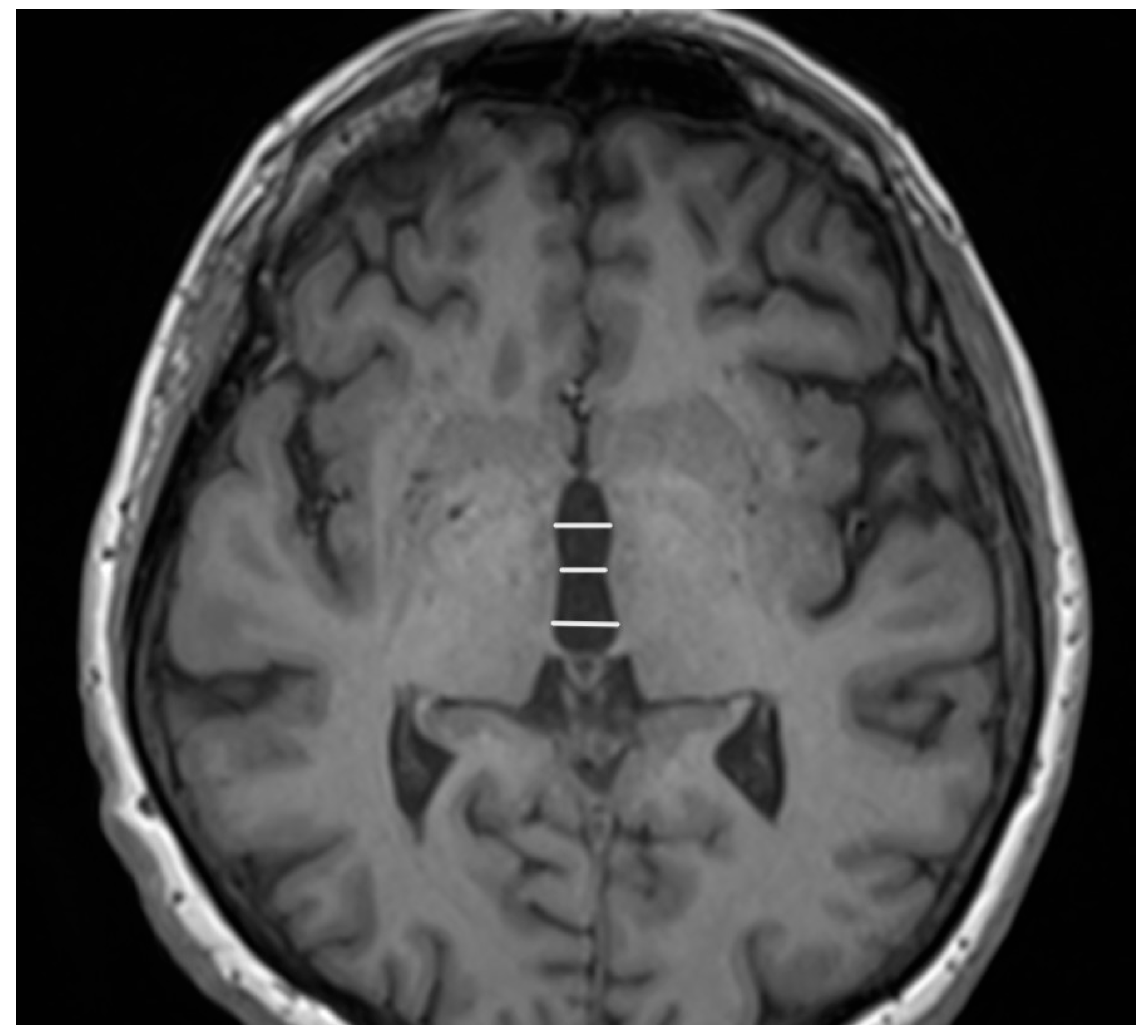 Diagnostics 15 00945 g005 Diagnostics 15 00945 g005