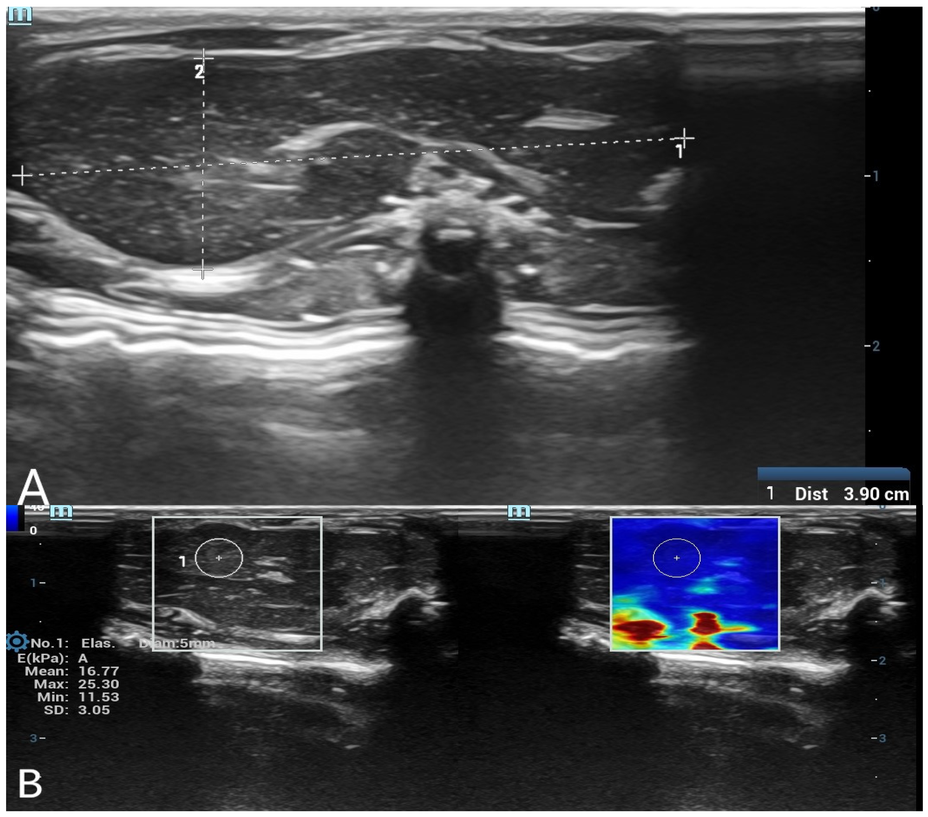 Diagnostics 15 00958 g001